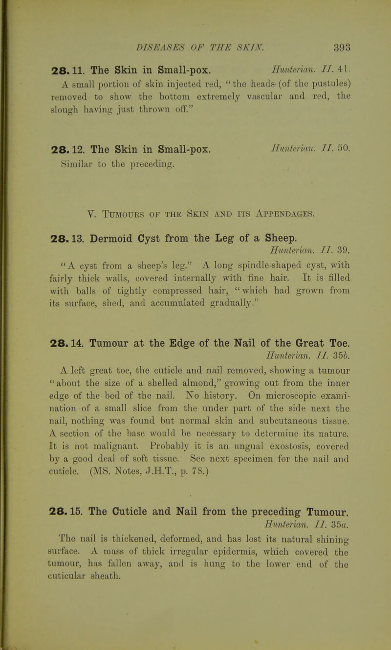 28.11. The Skin in Small-pox. Hunterian. II. 41. A small portion of skin injected red, the heads-(of the pustules) removed to show the bottom extremely vascular and red, the slough having just thrown off. 28.12. The Skin in Small-pox. Hunterian. II. 50. Similar to the preceding. V. Tumours of the Skin and its Appendages. 28.13. Dermoid Cyst from the Leg of a Sheep. Hunterian. II. 39. A cyst from a sheep's leg. A long spindle-shaped cyst, with fairly thick walls, covered internally with fine hair. It is filled with balls of tightly compressed hair, which had grown from its surface, shed, and accumulated gradually. 28.14. Tumour at the Edge of the Nail of the Great Toe. Hunterian. II. 3db. A left great toe, the cuticle and nail removed, showing a tumour  about the size of a shelled almond, growing out from the inner edge of the bed of the nail. No history. On microscopic exami- nation of a small slice from the under part of the side next the nail, nothing was found but normal skin and subcutaneous tissue. A section of the base would be necessary to determine its nature. It is not malignant. Probably it is an ungual exostosis, covered by a good deal of soft tissue. See next specimen for the nail and cuticle. (MS. Notes, J.H.T., p. 78.) 28.15. The Cuticle and Nail from the preceding Tumour. Hunterian. II. 35a. The nail is thickened, deformed, and has lost its natural shining surface. A mass of thick irregular epidermis, which covered the tumour, has fallen away, and is hung to the lower end of the cuticular sheath.