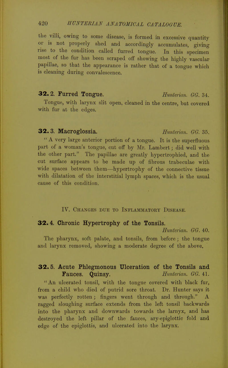 the villi, owing to some disease, is formed in excessive quantity or is not j^roperly shed and accordingly accumulates, giving rise to the condition called furred tongue. In this specimen most of the fur has been scraped off showing the highly vascular papillae, so that the appearance is rather that of a tongue which is cleaning during convalescence. 32.2. Furred Tongue. Huntei ian. GG. 34. Tongue, with larynx slit open, cleaned in the centre, but covered with fur at the edges. 32. 3. Macroglossia. Hunterian. GG. 35.  A very large anterior portion of a tongue. It is the superfluous part of a woman's tongue, cut off by Mr. Lambert; did well with the other part. The papillae are greatly hypertrophied, and the cut surface appears to be made up of fibrous trabeculae with wide spaces between them—hypertrophy of the connective tissue with dilatation of the interstitial lymph spaces, which is the usual cause of this condition. IV. Changes due to Inflammatory Disease. 32.4. Chronic Hypertrophy of the Tonsils. Hunterian. GG. 40. The pharynx, soft palate, and tonsils, from before; the tongue and larynx removed, showing a moderate degree of the above. 32.5. Acute Phlegmonous Ulceration of the Tonsils and Fauces. Quinsy. Hunterian. GG. 41. An ulcerated tonsil, with the tongue covered with black fur, from a child who died of putrid sore throat. Dr. Hunter says it was perfectly rotten; fingers went through and through. A ragged sloughing surface extends from the left tonsil backwards into the pharynx and downwards towards the larnyx, and has destroyed the left pillar of the fauces, ary-epiglottic fold and edge of the epiglottis, and ulcerated into the larynx.