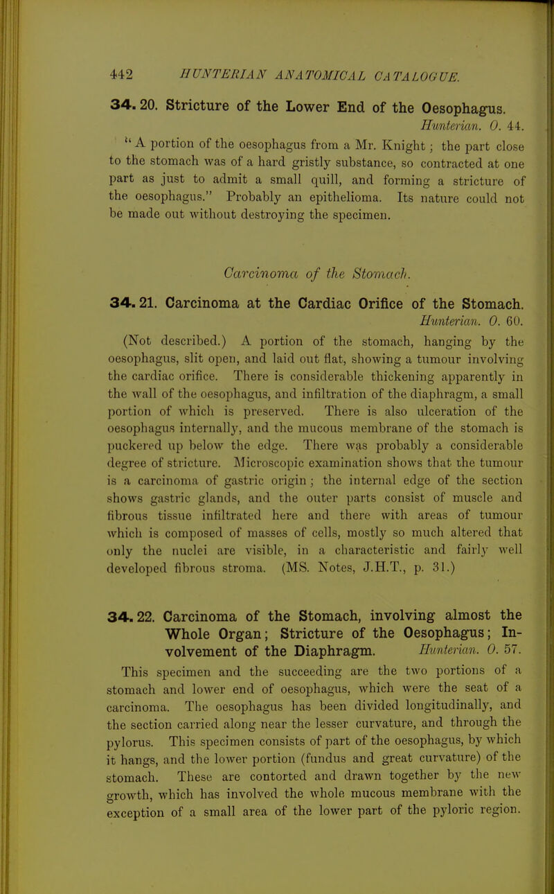 34.20. Stricture of the Lower End of the Oesophagus. Hunterian. 0. 44.  A portion of the oesophagus from a Mr. Knight; the part close to the stomach was of a hard gristly substance, so contracted at one part as just to admit a small quill, and forming a stricture of the oesophagus. Probably an epithelioma. Its nature could not be made out without destroying the specimen. Carcinoma of the Stomach. 34.21. Carcinoma at the Cardiac Orifice of the Stomach. Hunterian. 0. 60. (Not described.) A portion of the stomach, hanging by the oesophagus, slit open, and laid out fiat, showing a tumour involving the cardiac orifice. There is considerable thickening apparently in the wall of the oesophagus, and infiltration of the diaphragm, a small portion of which is preserved. There is also ulceration of the oesophagus internally, and the mucous membrane of the stomach is puckered up below the edge. There was probably a considerable degree of stricture. Microscopic examination shows that the tumour is a carcinoma of gastric origin; the internal edge of the section shows gastric glands, and the outer parts consist of muscle and fibrous tissue infiltrated here and there with areas of tumour Avhich is composed of masses of cells, mostly so much altered that only the nuclei are visible, in a characteristic and fairly well developed fibrous stroma. (MS. Notes, J.H.T., p. 31.) 34.22. Carcinoma of the Stomach, involving almost the Whole Organ; Stricture of the Oesophagus; In- volvement of the Diaphragm. Hunterian. 0. 57. This specimen and the succeeding are the two portions of a stomach and lower end of oesophagus, which were the seat of a carcinoma. The oesophagus has been divided longitudinally, and the section carried along near the lesser curvature, and through the pylorus. This specimen consists of part of the oesophagus, by which it hangs, and the lower portion (fundus and great curvature) of the stomach. These are contorted and drawn together by the new growth, which has involved the whole mucous membrane with the exception of a small area of the lower part of the pyloric region.