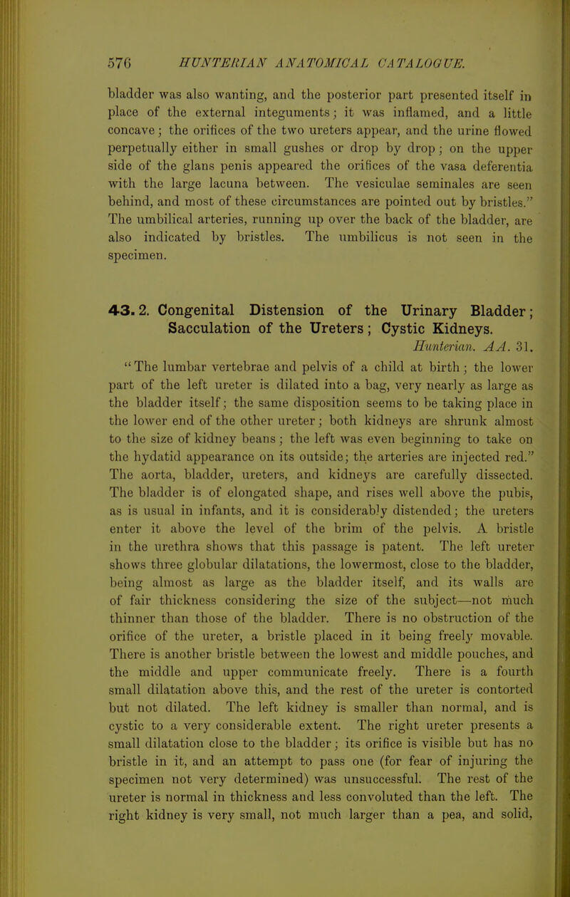 bladder was also wanting, and the posterior part presented itself in place of the external integuments; it was inflamed, and a little concave; the orifices of the two ureters appear, and the urine flowed perpetually either in small gushes or drop by drop; on the upper side of the glans penis appeared the orifices of the vasa deferentia with the large lacuna between. The vesiculae seminales are seen behind, and most of these circumstances are pointed out by bristles. The umbilical arteries, running up over the back of the bladder, are also indicated by bristles. The umbilicus is not seen in the specimen. 43.2. Congenital Distension of the Urinary Bladder; Sacculation of the Ureters; Cystic Kidneys. Hunterian. A A. 31. The lumbar vertebrae and pelvis of a child at birth; the lower part of the left ureter is dilated into a bag, very nearly as large as the bladder itself; the same disposition seems to be taking place in the lower end of the other ureter; both kidneys are shrunk almost to the size of kidney beans; the left was even beginning to take on the hydatid appearance on its outside; the arteries are injected red. The aorta, bladder, ureters, and kidneys are carefully dissected. The bladder is of elongated shape, and rises well above the pubis, as is usual in infants, and it is considerably distended; the ureters enter it above the level of the brim of the pelvis. A bristle in the urethra shows that this passage is patent. The left ureter shows three globular dilatations, the lowermost, close to the bladder, being almost as large as the bladder itself, and its walls are of fair thickness considering the size of the subject—not much thinner than those of the bladder. There is no obstruction of the orifice of the ureter, a bi'istle placed in it being freely movable. There is another bristle between the lowest and middle pouches, and the middle and upper communicate freely. There is a fourth small dilatation above this, and the rest of the ureter is contorted but not dilated. The left kidney is smaller than normal, and is cystic to a very considerable extent. The right ureter presents a small dilatation close to the bladder; its orifice is visible but has no bristle in it, and an attempt to pass one (for fear of injuring the specimen not very determined) was unsuccessful. The rest of the ureter is normal in thickness and less convoluted than the left. The right kidney is very small, not much larger than a pea, and solid,