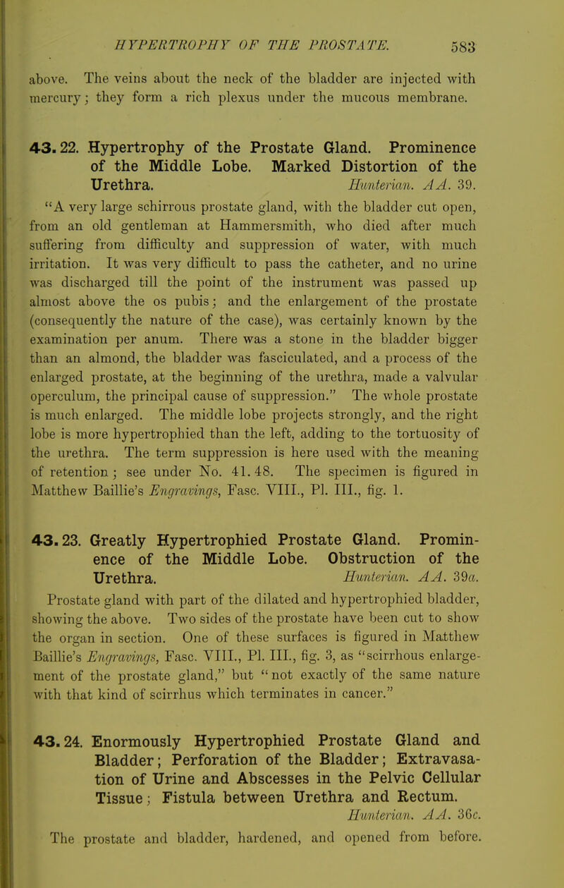 above. The veins about the neck of the bladder are injected w^ith mercury; they form a rich plexus under the mucous membrane. 43.22. .Hypertrophy of the Prostate Gland. Prominence of the Middle Lobe. Marked Distortion of the Urethra. Hunterian. A A. 39. A very large schirrous prostate gland, with the bladder cut open, from an old gentleman at Hammersmith, who died after much suffering from difficulty and suppression of water, Avith much irritation. It was very difficult to pass the catheter, and no urine was discharged till the point of the instrument was passed up almost above the os pubis; and the enlargement of the prostate (consequently the nature of the case), was certainly known by the examination per anum. There was a stone in the bladder bigger than an almond, the bladder was fasciculated, and a process of the enlarged prostate, at the beginning of the urethra, made a valvular operculum, the principal cause of suppression. The v.'hole prostate is much enlarged. The middle lobe projects strongly, and the right lobe is more hypertrophied than the left, adding to the tortuosity of the urethra. The term suppression is here used with the meaning of retention; see under No. 41.48. The specimen is figured in Matthew Baillie's Engravings, Fasc. VIII., PI. III., fig. 1. 43.23. Greatly Hypertrophied Prostate Gland. Promin- ence of the Middle Lobe. Obstruction of the Urethra. Hunterian. A A. 39a. Prostate gland with part of the dilated and hypertrophied bladder, showing the above. Two sides of the prostate have been cut to show the organ in section. One of these surfaces is figured in Matthew Bailhe's Engravings, Fasc. VIII., PI. Ill, fig. 3, as scirrhous enlarge- ment of the prostate gland, but  not exactly of the same nature with that kind of scirrhus which terminates in cancer. 43.24. Enormously Hypertrophied Prostate Gland and Bladder; Perforation of the Bladder; Extravasa- tion of Urine and Abscesses in the Pelvic Cellular Tissue; Fistula between Urethra and Rectum. Hunterian. A A. SGc. The prostate and bladder, hardened, and opened from before.