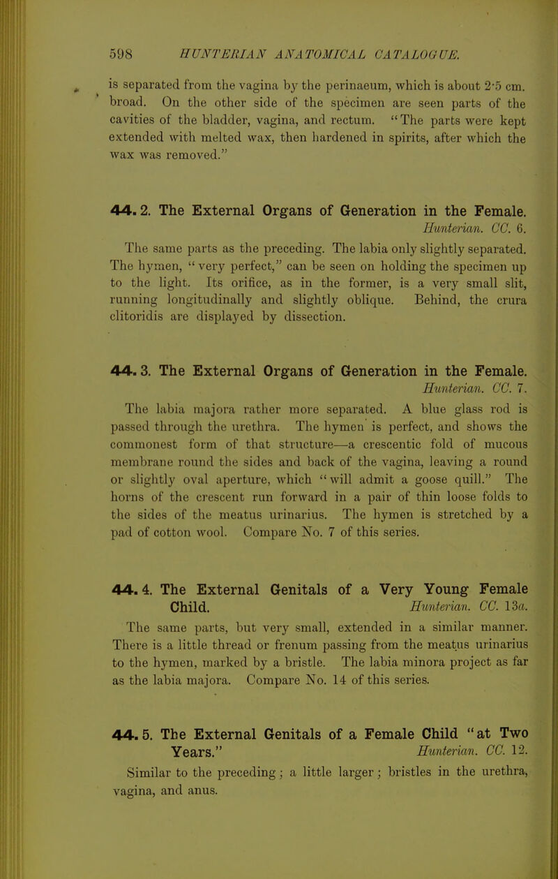is separated from the vagina b}- the perinaeum, which is about 2*5 cm. broad. On the other side of the specimen are seen parts of the cavities of the bladder, vagina, and rectum.  The parts were kept extended with melted wax, then hardened in spirits, after which the wax was removed. 44.2. The External Organs of Generation in the Female. Hunterian. CC. 6. The same parts as the preceding. The labia only slightly separated. The hymen,  very perfect, can be seen on holding the specimen up to the light. Its orifice, as in the former, is a very small sHt, running longitudinally and slightly oblique. Behind, the crura clitoridis are displayed by dissection. 44.3. The External Organs of Generation in the Female. Himterian. CO. 7. The labia majora rather more separated. A blue glass rod is passed through the urethra. The hymen is perfect, and shows the commonest form of that structure—a crescentic fold of mucous membrane round the sides and back of the vagina, leaving a round or slightly oval aperture, which will admit a goose quill. The horns of the crescent run forward in a pair of thin loose folds to the sides of the meatus urinarius. The hymen is stretched by a pad of cotton wool. Compare No. 7 of this series. 44.4. The External Genitals of a Very Young Female Child. Hunterian. CC. 13a. The same parts, but very small, extended in a similar manner. There is a little thread or frenum passing from the meatus urinarius to the hymen, marked by a bristle. The labia minora project as far as the labia majora. Compare No. 14 of this series. 44.5. The External Genitals of a Female Child at Two Years. Hunterian. CC. 12. Similar to the preceding; a little larger; bristles in the urethra, vagina, and anus.