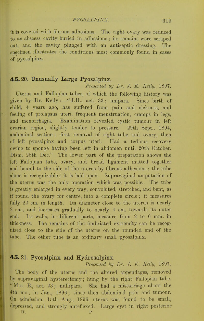 it is covered with fibrous adhesions. The right ovary was reduced to an abscess cavity buried in adhesions; its remains were scraped out, and the cavity plugged with an antiseptic dressing. The specimen iUustrates the conditions most commonly found in cases of pyosalpinx. 45.20. Unusually Large Pyosalpinx. Presented hy Dr. J. K. Kelly, 1897. Uterus and Fallopian tubes, of which the following history was given by Dr. Kelly:—J.H., aet. 33; unipara. Since birth of child, 4 years ago, has suffered from pain and sickness, and feeling of prolapsus uteri, frequent menstruation, cramps in legs, and menorrhagia. Examination revealed cystic tumour in left ovarian region, slightlj' tender to pressure. 29th Sept., 1894, abdominal section; first removal of right tube and ovary, then of left pyosalpinx and corpus uteri. Had a tedious recovery owing to sponge having been left in abdomen until 20th October. Dism. 28th Dec. The lower part of the preparation shows the left Fallopian tube, ovary, and broad ligament matted together and bound to the side of the uterus by fibrous adhesions; the tube alone is recognizable; it is laid open. Supravaginal amputation of the uterus was the only operation which was possible. The tube is greatly enlarged in every way, convoluted, stretched, and bent, as if round the ovary for centre, into a complete circle; it measures fully 22 cm. in length. Its diameter close to the uterus is nearly 2 cm., and increases gradually to nearly 4 cm. towards its outer end. Its walls, in different parts, measure from 2 to 6 mm. in thickness. The remains of the fimbriated extremity can be recog- nized close to the side of the uterus on the rounded end of the tube. The other tube is an ordinary small pyosalpinx. 45.21. Pyosalpinx and Hydrosalpinx. Presented hy Dr. J. K. Kelly, 1897. The body of the uterus and the altered appendages, removed by supravaginal hysterectomy; hung by the right Fallopian tube.  Mrs. B., aet. 23 ; nullipara. She had a miscarriage about the 4th mo., in Jan., 1896; since then abdominal pain and tumour. On admission, 15th Aug., 1896, uterus was found to be small, depressed, and strongly anteflexed. Large cyst in right posterior II. P