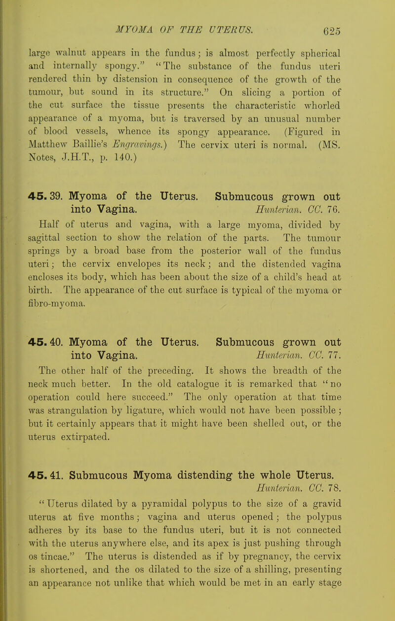 large walnut appears in the fundus; is almost perfectly spherical and internally spongy. The substance of the fundus uteri rendered thin by distension in consequence of the growth of the tumour, but sound in its structure. On slicing a portion of the cut surface the tissue presents the characteristic whorled appearance of a myoma, but is traversed by an unusual number of blood vessels, whence its spongy appearance. (Figured in Matthew Baillie's Engravings.) The cervix uteri is normal. (MS. Notes, J.H.T., p. 140.) 45.39. Myoma of the Uterus. Submucous grown out into Vagina. Hunterian. CO. 76. Half of uterus and vagina, with a large myoma, divided by sagittal section to show the relation of the parts. The tumour springs by a broad base from the posterior wall of the fundus uteri; the cervix envelopes its neck; and the distended vagina encloses its body, Avhich has been about the size of a child's head at birth. The appearance of the cut surface is typical of the myoma or fibro-myoma. 45.40. Myoma of the Uterus. Submucous grown out into Vagina. Hunterian. CC. 77. The other half of the preceding. It shows the breadth of the neck much better. In the old catalogue it is remarked that  no operation could here succeed. The only operation at that time was strangulation by ligature, which would not have been possible; but it certainly appears that it might have been shelled out, or the uterus extirpated. 45.41. Submucous Myoma distending the whole Uterus. Hunterian. CC. 78.  Uterus dilated by a pyramidal polypus to the size of a gravid uterus at five months; vagina and uterus opened ; the polypus adheres by its base to the fundus uteri, but it is not connected with the uterus anywhere else, and its apex is just pushing through OS tincae. The uterus is distended as if by pregnancy, the cervix is shortened, and the os dilated to the size of a shilling, presenting an appearance not unlike that which would be met in an early stage