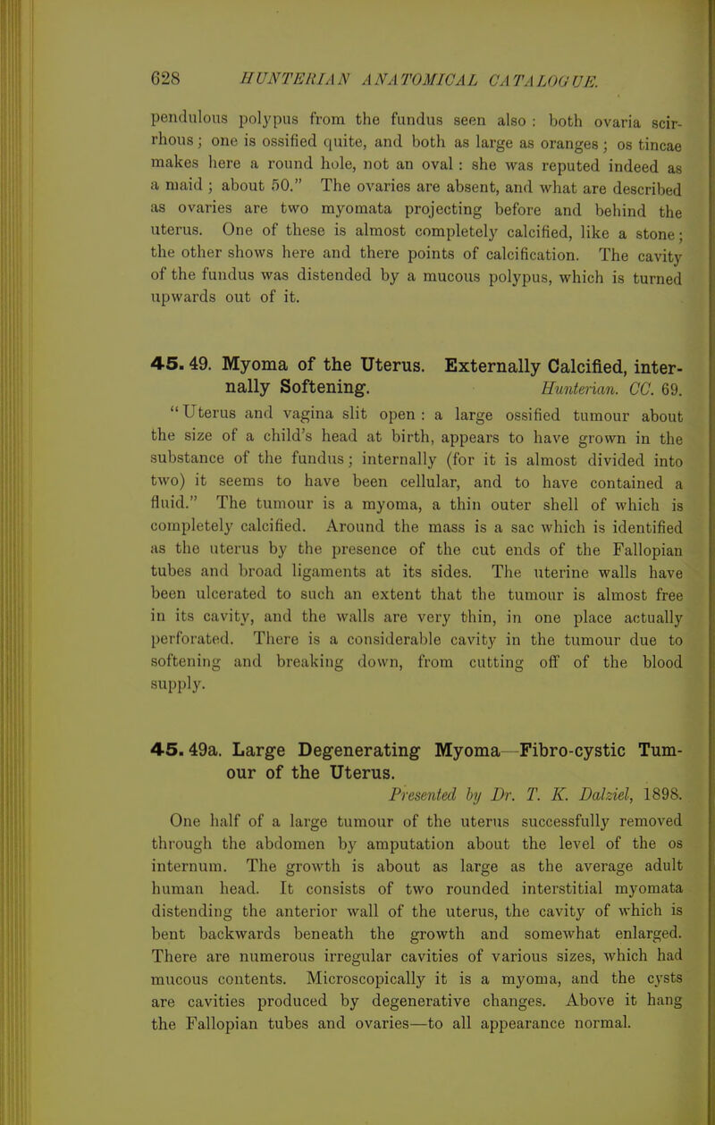 pendulous polypus from the fundus seen also : both ovaria scir- rhous ; one is ossified quite, and both as large as oranges; os tincae makes here a round hole, not an oval: she was reputed indeed as a maid ; about 50. The ovaries are absent, and what are described as ovaries are two myomata projecting before and behind the uterus. One of these is almost completely calcified, like a stone; the other shows here and there points of calcification. The cavity of the fundus was distended by a mucous polypus, which is turned upwards out of it. 45,49. Myoma of the Uterus. Externally Calcified, inter- nally Softening. Hunterian. CC. 69. Uterus and vagina slit open: a large ossified tumour about the size of a child's head at birth, appears to have grown in the substance of the fundus; internally (for it is almost divided into two) it seems to have been cellular, and to have contained a fluid. The tumour is a myoma, a thin outer shell of which is completely calcified. Around the mass is a sac which is identified as the uterus by the presence of the cut ends of the Fallopian tubes and broad ligaments at its sides. The uterine walls have been ulcerated to such an extent that the tumour is almost free in its cavity, and the walls are very thin, in one place actually perforated. There is a considerable cavity in the tumour due to softening and breaking down, from cutting off of the blood supply. 4-5.49a. Large Degenerating- Myoma—Fibro-cystic Tum- our of the Uterus. Presented by Dr. T. K. Dalziel, 1898. One half of a large tumour of the uterus successfully removed through the abdomen by amputation about the level of the os internum. The growth is about as large as the average adult human head. It consists of two rounded interstitial myomata distending the anterior wall of the uterus, the cavity of which is bent backwards beneath the growth and somewhat enlarged. There are numerous irregular cavities of various sizes, which had mucous contents. Microscopically it is a myoma, and the cysts are cavities produced by degenerative changes. Above it hang the Fallopian tubes and ovaries—to all appearance normal.