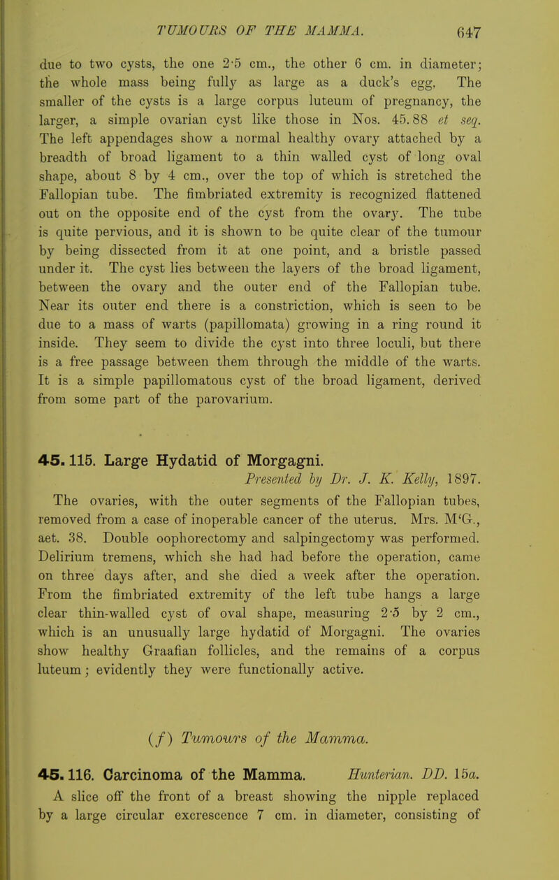 due to two cysts, the one 2-5 cm., the other 6 cm. in diameter; the whole mass being fully as large as a duck's egg. The smaller of the cysts is a large corpus luteum of pregnancy, the larger, a simple ovarian cyst like those in Nos. 45.88 et seq. The left appendages show a normal healthy ovary attached by a breadth of broad ligament to a thin walled cyst of long oval shape, about 8 by 4 cm., over the top of which is stretched the Fallopian tube. The fimbriated extremity is recognized flattened out on the opposite end of the cyst from the ovar3^ The tube is quite pervious, and it is shown to be quite clear of the tumour by being dissected from it at one point, and a bristle passed under it. The cyst lies between the layers of the broad ligament, between the ovary and the outer end of the Fallopian tube. Near its outer end there is a constriction, which is seen to be due to a mass of warts (papillomata) growing in a ring round it inside. They seem to divide the cyst into three loculi, but there is a free passage between them through the middle of the warts. It is a simple papillomatous cyst of the broad ligament, derived from some part of the parovarium. 45.115. Large Hydatid of Morgagni. Presented by Dr. J. K. Kelly, 1897. The ovaries, with the outer segments of the Fallopian tubes, removed from a case of inoperable cancer of the uterus. Mrs. M'G., aet. 38. Double oophorectomy and salpingectomy was performed. Delirium tremens, which she had had before the operation, came on three days after, and she died a Aveek after the operation. From the fimbriated extremity of the left tube hangs a large clear thin-walled cyst of oval shape, measuring 2-5 by 2 cm., which is an unusually large hydatid of Morgagni. The ovaries show healthy Graafian follicles, and the remains of a corpus luteum; evidently they were functionally active. (/) Tumours of the Mamma. 45.116. Carcinoma of the Mamma. Hunterian. DD. 15a. A slice off the front of a breast showing the nipple replaced by a large circular excrescence 7 cm. in diameter, consisting of