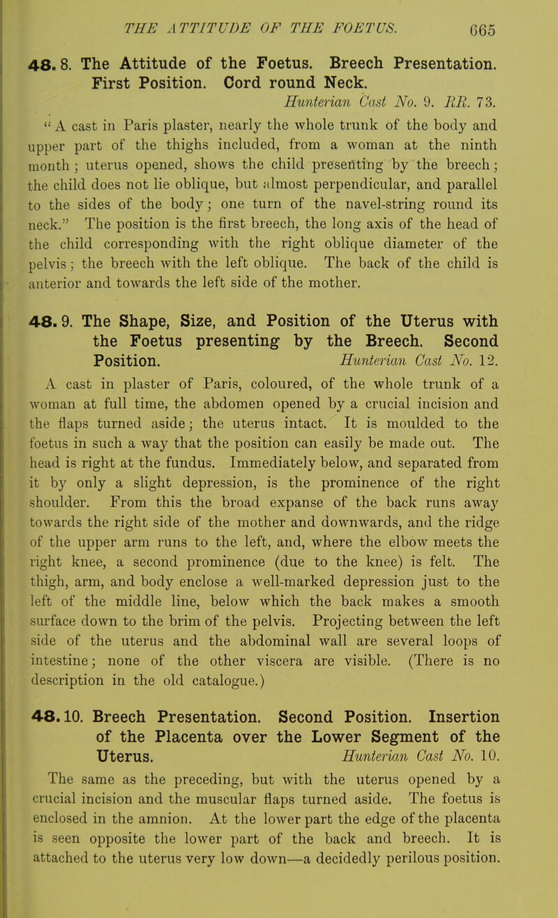 48.8. The Attitude of the Foetus. Breech Presentation. First Position. Cord round Neck. Hunterian Cast No. 9. BE. 73. A cast in Paris plaster, nearly the whole trunk of the body and upper part of the thighs included, from a woman at the ninth month ; uterus opened, shows the child presenting by the breech; the child does not lie oblique, but iilmost perpendicular, and parallel to the sides of the body; one turn of the navel-string round its neck. The position is the first breech, the long axis of the head of the child corresponding with the right oblique diameter of the pelvis; the breech with the left oblique. The back of the child is anterior and towards the left side of the mother. 48.9. The Shape, Size, and Position of the Uterus with the Foetus presenting by the Breech. Second Position. Hunterian Cast No. 12. A cast in plaster of Paris, coloured, of the whole trunk of a woman at full time, the abdomen opened by a crucial incision and the flaps turned aside; the uterus intact. It is moulded to the foetus in such a way that the position can easily be made out. The head is right at the fundus. Immediately below, and separated from it by only a slight depression, is the prominence of the right shoulder. From this the broad expanse of the back runs away towards the right side of the mother and downwards, and the ridge of the upper arm runs to the left, and, where the elbow meets the right knee, a second prominence (due to the knee) is felt. The thigh, arm, and body enclose a well-marked depression just to the left of the middle line, below which the back makes a smooth surface down to the brim of the pelvis. Projecting between the left side of the uterus and the abdominal wall are several loops of intestine; none of the other viscera are visible. (There is no description in the old catalogue.) 48.10. Breech Presentation. Second Position. Insertion of the Placenta over the Lower Segment of the Uterus. Hunterian Cast No. 10. The same as the preceding, but with the uterus opened by a crucial incision and the muscular flaps turned aside. The foetus is enclosed in the amnion. At the lower part the edge of the placenta is seen opposite the lower part of the back and breech. It is attached to the uterus very low down—a decidedly perilous position.