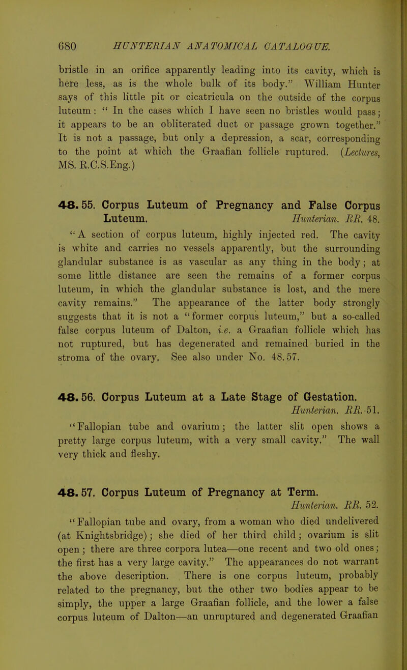 bristle in an orifice apparently leading into its cavity, which is here less, as is the whole bulk of its body. William Hunter says of this little pit or cicatricula on the outside of the corpus luteum :  In the cases which I have seen no bristles would pass; it appears to be an obliterated duct or passage grown together. It is not a passage, but only a depression, a scar, corresponding to the point at which the Graafian follicle ruptured. {Lectures, MS. KC.S.Eng.) 48.55. Corpus Luteum of Pregnancy and False Corpus Luteum. Hunterian. BE, 48.  A section of corpus luteum, highly injected red. The cavity is white and carries no vessels apparently, but the surrounding glandular substance is as vascular as any thing in the body; at some little distance are seen the remains of a former corpus luteum, in which the glandular substance is lost, and the mere cavity remains. The appearance of the latter body strongly suggests that it is not a former corpus luteum, but a so-called false corpus luteum of Dal ton, i.e. a Graafian follicle which has not ruptured, but has degenerated and remained buried in the stroma of the ovary. See also under No. 48.57. 48.56. Corpus Luteum at a Late Stage of Gestation. Hunterian. BE. 51. Fallopian tube and ovarium; the latter slit open shows a pretty large corpus luteum, with a very small cavity. The wall very thick and fleshy. 48.57. Corpus Luteum of Pregnancy at Term. Hunterian. BB. 52.  Fallopian tube and ovary, from a woman who died undelivered (at Knightsbridge); she died of her third child; ovarium is slit open ; there are three corpora lutea—one recent and two old ones; the first has a very large cavity. The appearances do not warrant the above description. There is one corpus luteum, probably related to the pregnancy, but the other two bodies appear to be simply, the upper a large Graafian follicle, and the lower a false corpus luteum of Dalton—an unruptured and degenerated Graafian