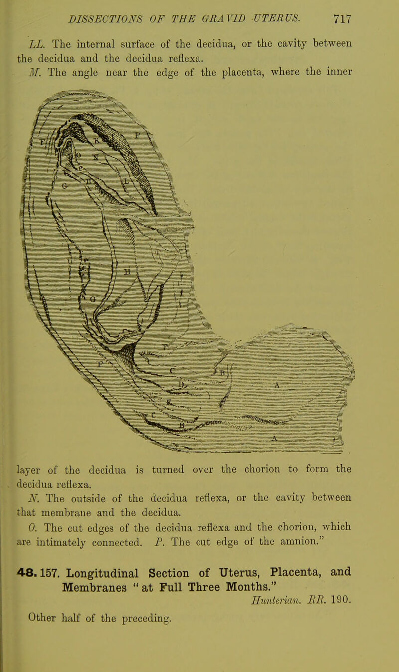 LL. The internal surface of the decidua, or the cavity between the decidua and the decidua reflexa. M. The angle near the edge of the placenta, where the inner layer of the decidua is turned over the chorion to form the decidua reflexa. iY. The outside of the decidua reflexa, or the cavity between that membrane and the decidua. 0. The cut edges of the decidua reflexa and the chorion, which are intimately connected. P. The cut edge of the amnion. 48.157. Longitudinal Section of Uterus, Placenta, and Membranes  at Full Three Months. Hunterian. BR. 190. Other half of the preceding.