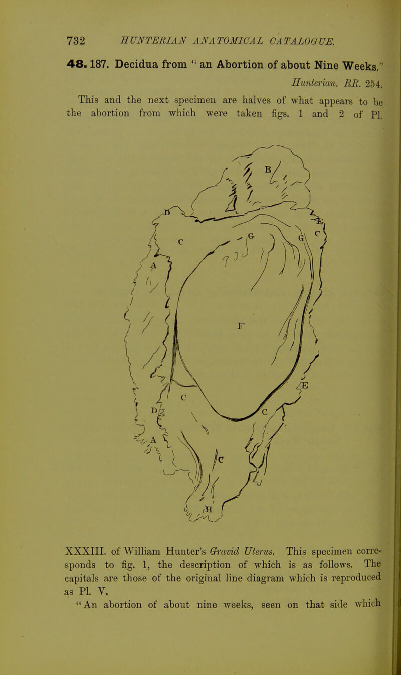 48.187. Decidua from  an Abortion of about Nine Weeks.' Hunterian. Rli. 254. This and the next specimen are halves of what appears to be the abortion from which were taken figs. 1 and 2 of PI. XXXIII. of William Hunter's Gravid Uterus. This specimen corre- sponds to fig. 1, the description of which is as follows. The capitals are those of the original line diagram which is reproduced as PL V. An abortion of about nine weeks, seen on that side which