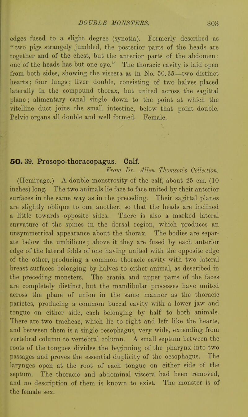 edges fused to a slight degree (synotia). Formerly described as  two pigs strangely jumbled, the posterior parts of the heads are together and of the chest, but the anterior parts of the abdomen : one of the heads has but one eye. The thoracic cavity is laid open from both sides, showing the viscera as in No. 50.35—two distinct hearts; four lungs; liver double, consisting of two halves placed laterally in the compound thorax, but united across the sagittal plane; alimentary canal single down to the point at which the vitelline duct joins the small intestine, below that point double. Pelvic organs all double and well formed. Female. 50.39. Prosopo-thoracopagus. Calf. From D?: Allen Thomson's Collection. (Hemipage.) A double monstrosity of the calf, about 25 cm. (10 inches) long. The two animals lie face to face united by their anterior surfaces in the same way as in the preceding. Their sagittal planes are slightly oblique to one another, so that the heads are inclined a little towards opposite sides. There is also a marked lateral curvature of the spines in the dorsal region, which produces an unsymmetrical appearance about the thorax. The bodies are separ- ate below the umbilicus; above it they are fused by each anterior edge of the lateral folds of one having united with the opposite edge of the other, producing a common thoracic cavity with two lateral breast surfaces belonging by halves to either animal, as described in the preceding monsters. The crania and upper parts of the faces are completely distinct, but the mandibular processes have united across the plane of union in the same manner as the thoracic parietes, producing a common buccal cavity with a lower jaw and tongue on either side, each belonging by half to both animals. There are two tracheae, which lie to right and left like the hearts, and between them is a single oesophagus, very wide, extending from vertebral column to vertebral column. A small septum between the roots of the tongues divides the beginning of the pharynx into two passages and proves the essential duplicity of the oesophagus. The larynges open at the root of each tongue on either side of the septum. The thoracic and abdominal viscera had been removed, and no description of them is known to exist. The monster is of the female sex.