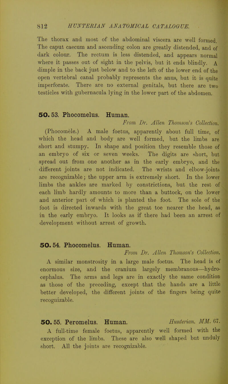 The thorax and most of the abdominal viscera are well formed. The caput caecum and ascending colon are greatly distended, and of dark colour. The rectum is less distended, and appears normal where it passes out of sight in the pelvis, but it ends bHndly. A dimple in the back just below and to the left of the lower end of the open vertebral canal probably represents the anus, but it is quite imperforate. There are no external genitals, but there are two testicles with gubernacula lying in the lower part of the abdomen. 50.53. Phocomelus. Human. From Dr. Allen Thomson's Collection. (Phocomele.) A male foetus, apparently about full time, of which the head and body are well formed, but the limbs are short and stumpy. In shape and position they resemble those of an embryo of six or seven weeks. The digits are short, but spread out from one another as in the early embryo, and the different joints are not indicated. The wrists and elbow-jointb are recognizable; the upper arm is extremely short. In the lower limbs the ankles are marked by constrictions, but the rest of each limb hardly amounts to more than a buttock, on the lower and anterior part of which is planted the foot. The sole of the foot is directed inwards with the great toe nearer the head, as in the early embryo. It looks as if there had been an arrest of development without arrest of growth. 50.54. Phocomelus. Human. From Dr. Allen Thomson's Collection. A similar monstrosity in a large male foetus. The head is of enormous size, and the cranium largely membranous—hydro- cephalus. The arms and legs are in exactly the same condition as those of the pi-eceding, except that the hands are a little better developed, the different joints of the fingers being quite recognizable. 50. 55. Peromelus. Human. Hunierian. MM. 67. A full-time female foetus, apparently well formed with the exception of the limbs. These are also well shaped but unduly short. All the joints are recognizable.