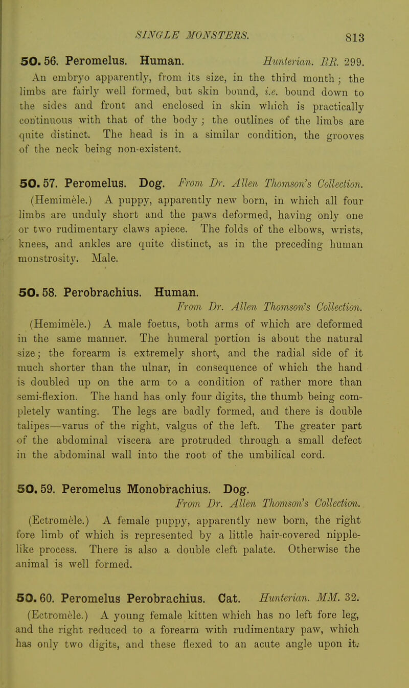 50.56. Peromelus. Human. Hunterian. Rll 299. An embryo apparently, from its size, in the third month; the limbs are fairly well formed, but skin bound, i.e. bound down to the sides and front and enclosed in skin which is practically continuous with that of the body ; the outlines of the limbs are quite distinct. The head is in a similar condition, the grooves of the neck being non-existent. 50.57. Peromelus. Dog. From Dr. Allen Thomson's Collection. (Hemimele.) A puppy, apparently new born, in which all four limbs are unduly short and the paws deformed, having only one or two rudimentary claws apiece. The folds of the elbows, wrists, knees, and ankles are quite distinct, as in the preceding human monstrosity. Male. 50.58. Perobrachius. Human. From Dr. Allen Thomson's Collection. (Hemimele.) A male foetus, both arms of which are deformed in the same manner. The humeral portion is about the natural size; the forearm is extremely short, and the radial side of it much shorter than the ulnar, in consequence of which the hand is doubled up on the arm to a condition of rather more than semi-flexion. The hand has only four digits, the thumb being com- pletely wanting. The legs are badly formed, and there is double talipes—varus of the right, valgus of the left. The greater part of the abdominal viscera are protruded through a small defect in the abdominal wall into the root of the umbilical cord. 50.59. Peromelus Monobrachius. Dog. From Dr. Allen Thomson's Collection. (Ectrom^le.) A female puppy, apparently new born, the right fore limb of which is represented by a little hair-covered nipple- like process. There is also a double cleft palate. Otherwise the animal is well formed. 50.60. Peromelus Perobrachius. Cat. Hunterian. MM. 32. (Ectromele.) A young female kitten which has no left fore leg, and the right reduced to a forearm with rudimentary paw, which has only two digits, and these flexed to an acute angle upon it;