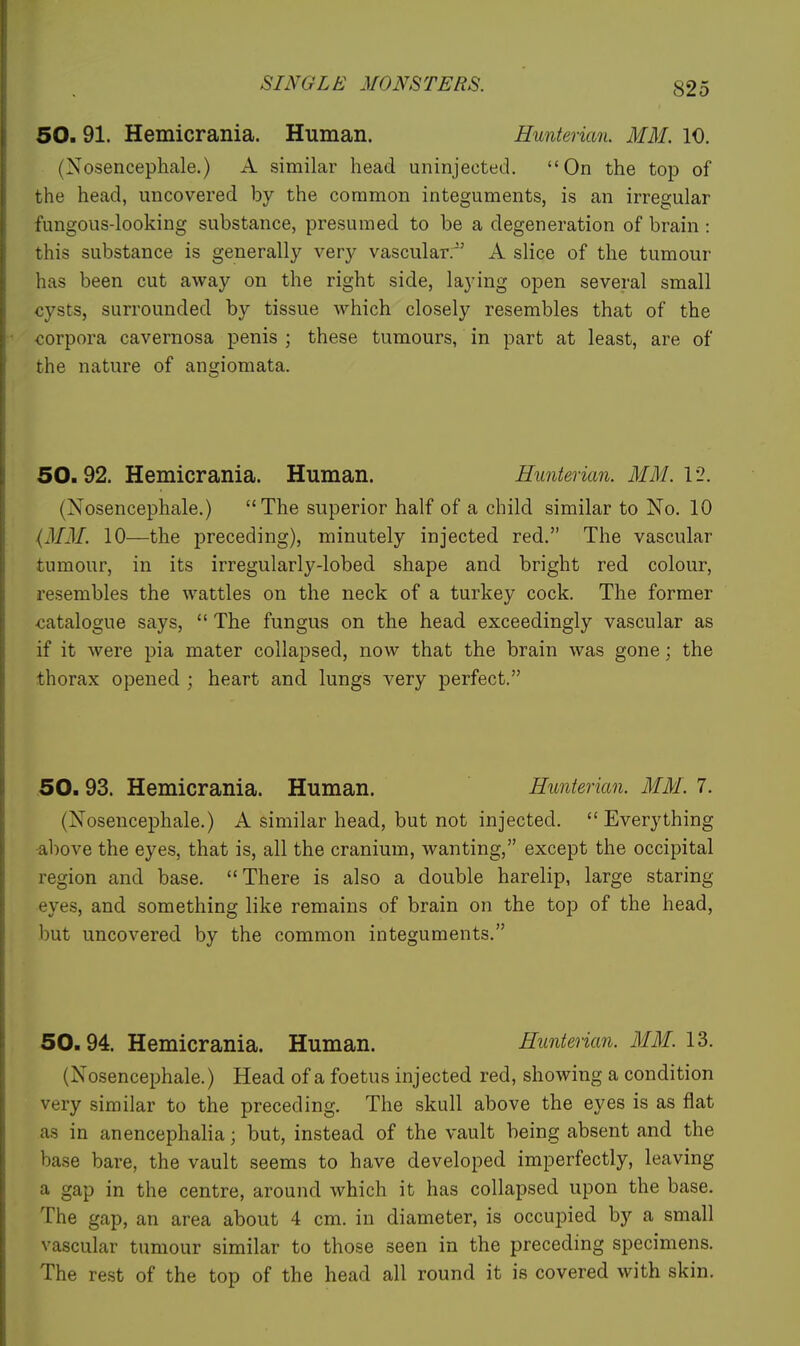 50. 91. Hemicrania. Human. Hunterian. MM. 10. (Nosencephale.) A similar head uninjected. On the top of the head, uncovered by the common integuments, is an irregular fungous-looking substance, presumed to be a degeneration of brain : this substance is generally very vascular.'' A slice of the tumour has been cut away on the right side, laying open several small cysts, surrounded by tissue which closely resembles that of the corpora cavernosa penis ; these tumours, in part at least, are of the nature of angiomata. 50.92. Hemicrania. Human. Hunterian. MM. 12. (Nosencephale.) The superior half of a child similar to No. 10 (M3f. 10—the preceding), minutely injected red. The vascular tumour, in its irregularly-lobed shape and bright red colour, resembles the wattles on the neck of a turkey cock. The former catalogue says,  The fungus on the head exceedingly vascular as if it were pia mater collapsed, now that the brain was gone; the thorax opened ; heart and lungs very perfect. 50.93. Hemicrania. Human. Hunterian. MM. 7. (Nosencephale.) A similar head, but not injected. Everything ■above the eyes, that is, all the cranium, wanting, except the occipital region and base. There is also a double harelip, large staring eyes, and something like remains of brain on the top of the head, but uncovered by the common integuments. 50.94. Hemicrania. Human. Hunterian. MM. 13. (Nosencephale.) Head of a foetus injected red, showing a condition very similar to the preceding. The skull above the eyes is as flat as in anencephalia; but, instead of the vault being absent and the base bare, the vault seems to have developed imperfectly, leaving a gap in the centre, around which it has collapsed upon the base. The gap, an area about 4 cm. in diameter, is occupied by a small vascular tumour similar to those seen in the preceding specimens. The rest of the top of the head all round it is covered with skin.
