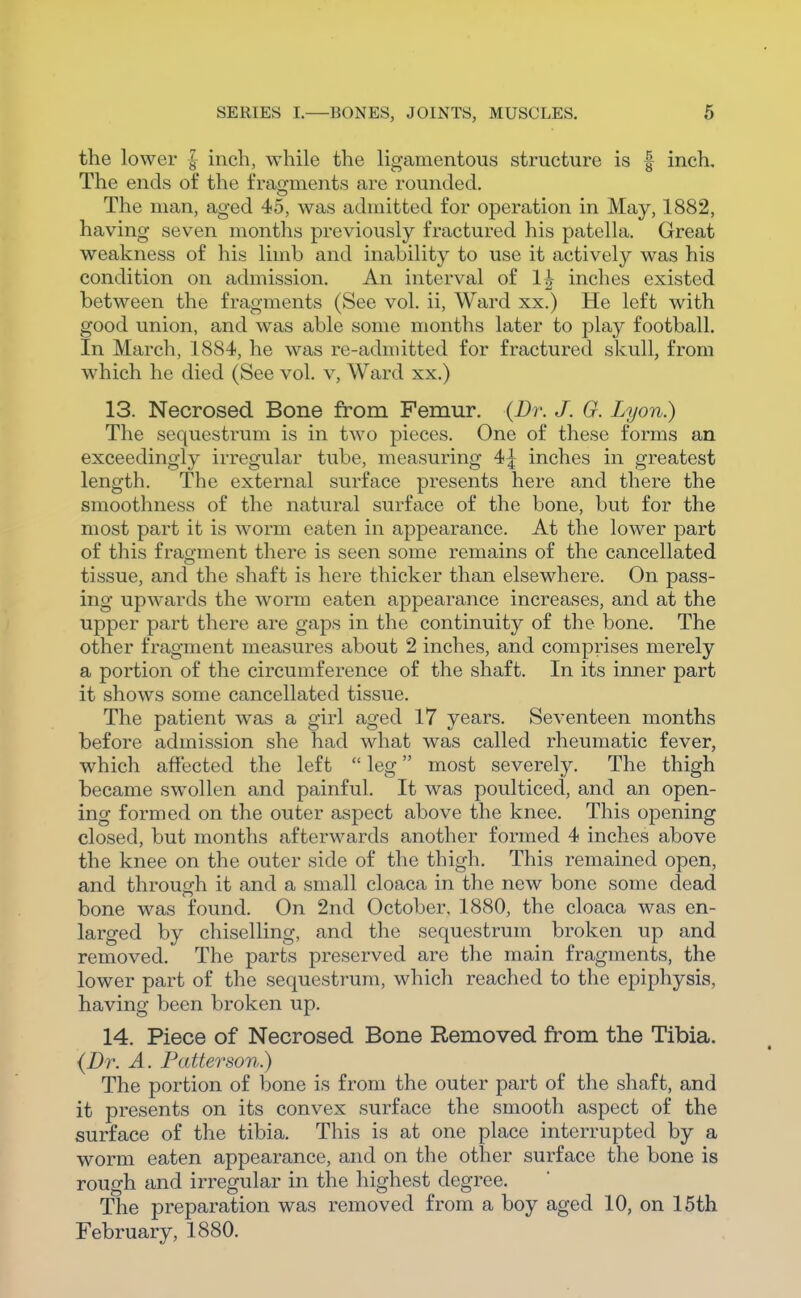 the lower | inch, while the ligamentous structure is | inch. The ends of the fraijments are rounded. The man, aged 45, was admitted for operation in May, 1882, having seven months previously fractured his patella. Great weakness of his limb and inability to use it actively was his condition on admission. An interval of 1|- inches existed between the fragments (See vol. ii, Ward xx.) He left with good union, and was able some months later to play football. In March, 1884, he was re-admitted for fractured skull, from which he died (See vol. v. Ward xx.) 13. Necrosed Bone from Femur. {Dr. J. G. Lyon.) The sequestrum is in two pieces. One of these forms an exceedingly irregular tube, measuring 4| inches in greatest length. The external surface presents here and there the smoothness of the natural surface of the bone, but for the most part it is worm eaten in appearance. At the lower part of this fragment there is seen some remains of the cancellated tissue, and the shaft is here thicker than elsewhere. On pass- ing upwards the worm eaten appearance increases, and at the upper part there are gaps in the continuity of the bone. The other fragment measures about 2 inches, and comprises merely a portion of the circumference of the shaft. In its inner part it shows some cancellated tissue. The patient was a girl aged 17 years. Seventeen months before admission she had what was called rheumatic fever, which affected the left  leg most severely. The thigh became swollen and painful. It was poulticed, and an open- ing formed on the outer aspect above the knee. This opening closed, but months afterwards another formed 4 inches above the knee on the outer side of the thigh. This remained open, and through it and a small cloaca in the new bone some dead bone was found. On 2nd October, 1880, the cloaca was en- larged by chiselling, and the sequestrum broken up and removed. The parts preserved are the main fragments, the lower part of the sequestrum, which reached to the epiphysis, having been broken up. 14. Piece of Necrosed Bone Removed fi^om the Tibia. {Dr. A. Patterson) The portion of bone is from the outer part of the shaft, and it presents on its convex surface the smooth aspect of the surface of the tibia. This is at one place interrupted by a worm eaten appearance, and on the other surface the bone is rough and irregular in the highest degree. The preparation was removed from a boy aged 10, on 15th February, 1880.
