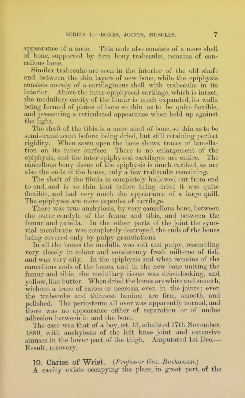 appearance of a node. This node also consists of a mere shell of bone, supported by firm bony trabecula3, remains of can- cellous bone. Similar trabecules are seen in the interior of the old shaft and between the thin layers of new bone, while the epiphysis consists merely of a cartilaginous shell with trabecula3 in its interior. Above the inter-epiphyseal cartilage, which is intact, the medullary cavity of the fenmr is much expanded, its walls being formed of plates of bone so thin as to be quite flexible, and presenting a reticulated appearance when held up against the lio-ht. The shaft of the tibia is a mere shell of bone, so thin as to be semi-translucent before being dried, but still retaining perfect rigidity. When sawn open the bone shows traces of lamella- tion on its inner surface. There is no enlargement of the epiphysis, and the inter-epiphyseal cartilages are entire. The cancellous bony tissue of the epiphysis is much raritied, as are also the ends of the bones, only a few trabeculfB remaining. The shaft of the fibula is completely hollowed out from end to end, and is so thin that before being dried it was quite flexible, and had very much the appearance of a large quill. The epiphyses are mere capsules of cartilage. There was true anchylosis, by very cancellous bone, between the outer condyle of the femur and tibia, and between the femur and patella. In the other parts of the joint the syno- vial membrane was completely destroyed, the ends of the bones being covered only by pulpy granulations. In all the bones the medulla was soft and pulpy, resembling very closely in colour and consistency fresh milt-roe of fish, and was very oily. In the epiphysis and what remains of the cancellous ends of the bones, and in the new bone uniting the femur and tibia, the medullary tissue was dried-looking, and yellow, like butter. When dried the bones are white and smooth, without a trace of caries or necrosis, even in the joints; even the trabeculse and thinnest laminse are firm, smooth, and polished. The periosteum all over was apparently normal, and there was no appearance either of separation or of undue adhesion between it and the bone. The case was that of a boy, set. 18, admitted l7th November, 1880, with anchylosis of the left knee joint and extensive sinuses in the lower part of the thigh. Amputated 1st Dec.— Result, recovery. 19. Caries of Wrist. {Professor Geo. Buchanan.) A cavity exists occupying the place, in great part, of the