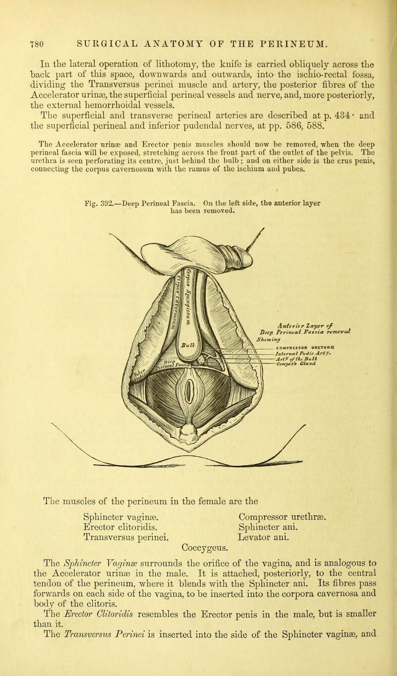 In tlie lateral operation of lithotomy, the knife is carried obliquely across the back part of this space, downwards and outwards, into the ischio-rectal fossa, dividing the Transversus perinei muscle and artery, the posterior fibres of the Accelerator urinas, the superficial perineal vessels and nerve, and, more posteriorly, the external hemorrhoidal vessels. The superficial and transverse perineal arteries are described at p. 434 • and the superficial perineal and inferior pudendal nerves, at pp. 586, 588. The Accelerator urinse and Erector penis muscles should now be removed, when the deep perineal fascia will be exposed, stretching across the front part of the outlet of the pelvis. The urethra is seen perforating its centre, just behind the bulb ; and on either side is the crus penis, connecting the corpus cavernosum with the ramus of the ischium and pubes. Fig. 392.—Deep Perineal Fascia. On the left side, the anterior layer has been removed. The muscles of the perineum in the female are the Sphincter vaginfe. Compressor urethra. Erector clitoridis. Sphincter ani. Transversus perinei. Levator ani. Coccygeus. The Sphincter Vaginse surrounds the orifice of the vagina, and is analogous to the Accelerator urinse in the male. It is attached, posteriorly, to the central tendon of the perineum, where it blends with the Sphincter ani. Its fibres pass forwards on each side of the vagina, to be inserted into the corpora cavernosa and body of the clitoris. The Erector Clitoridis resembles the Erector penis in the male, but is smaller than it. The Transversus Perinei is inserted into the side of the Sphincter vaginaa, and