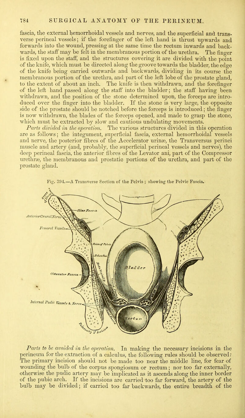 fascia, the external hemorrhoidal vessels and nerves, and the superficial and trans- verse perineal vessels; if the forefinger of the left hand is thrust upwards and forwards into the wound, pressing at the same time the rectum inwards and back- wards, the staff' may be felt in the membranous portion of the urethra. The finger is fixed upon the staffj and the structures covering it are divided with the point of the knife, which must be directed along the groove towards the bladder, the edge of the knife being carried outwards and backwards, dividing in its course the membranous portion of the urethra, and part of the left lobe of the prostate gland, to the extent of about an inch. The knife is then Avithdrawn, and the forefinger of the left hand passed along the staff into the bladder; the staff having been Avithdrawn, and the position of the stone determined upon, the forceps are intro- duced over the finger into the bladder. If the stone is very large, the opposite side of the prostate should be notched before the forceps is introduced; the finger is now withdrawn, the blades of the forceps opened, and made to grasp the stone, which must be extracted by slow and cautious undulating movements. Paris divided in the operation. The various structures divided in this operation are as follows; the integument, superficial fascia, external hemorrhoidal vessels and nerve, the posterior fibres of the Accelerator urince, the Transversus perinei muscle and artery (and, probably, the superficial perineal vessels and nerves), the deep perineal fascia, the anterior fibres of the Levator ani, part of the Compressor urethrte, the membranous and prostatic portions of the urethra, and part of the prostate gland. Fig. 394.—A Trausverse Section of the Pelvis ; showing the Pelvic Fascia. Pa,rts to he avoided in the operation. In making the necessary incisions in the perineum for the extraction of a calculus, the following rules should be observed: The primary incision should not be made too near the middle line, for fear of wounding the bulb of the corpus spongiosum or rectum; nor too far externally, otherwise the pudic artery may be implicated as it ascends along the inner border of the pubic arch. If the incisions are carried too far forward, the artery of the bulb may be divided; if carried too far backwards, the entire breadth of the