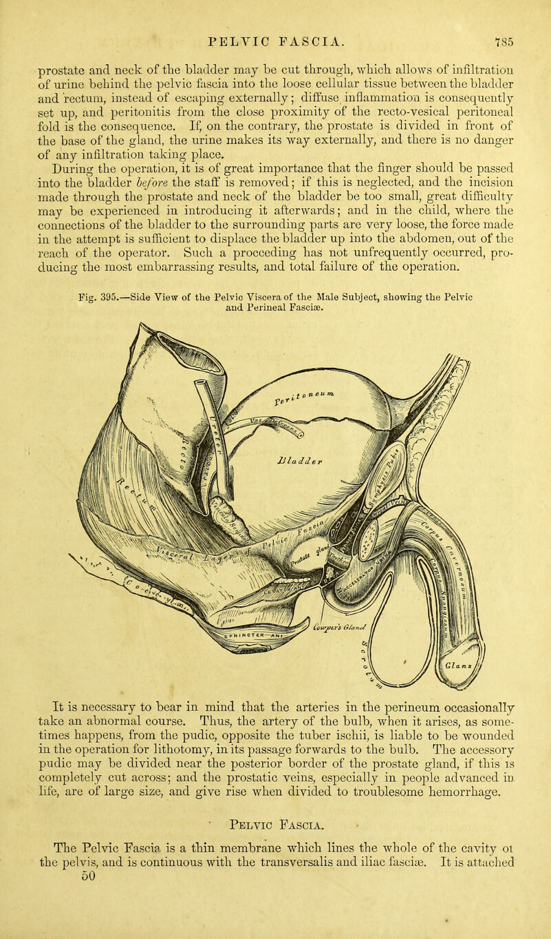 prostate and neck of tlie bladder may be cut througb, wliicb allows of infiltration of urine behind the pelvic fascia into the loose cellular tissue between the bladder and rectum, instead of escaping externally; diffuse inflammation is consequently set up, and peritonitis from the close proximity of the recto-vesical peritoneal fold is the consequence. If, on the contrary, the prostate is divided in front of the base of the gland, the urine makes its way externally, and there is no danger of any infiltration taking place. During the operation, it is of great importance that the finger should be passed into the bladder before the staff is removed; if this is neglected, and the incision made through the prostate and neck of the bladder be too small, great difficulty may be experienced in introducing it afterwards; and in the child, where the connections of the bladder to the surrounding parts are very loose, the force made in the attempt is sufficient to displace the bladder up into the abdomen, out of the reach of the operator. Such a proceeding has not unfrequently occurred, pro- ducing the most embarrassing results, and total failure of the operation. Fig. 395.—Side View of the Pelvic Viscera of the Male Subject, showing the Pelvic and Perineal Fasciae. It is necessary to bear in mind that the arteries in the perineum occasionally take an abnormal course. Thus, the artery of the bulb, when it arises, as some- times happens, from the pudic, opposite the tuber ischii, is liable to be wounded in the operation for lithotomy, in its passage forwards to the bulb. The accessory pudic may be divided near the posterior border of the prostate gland, if this is completely cut across; and the prostatic veins, especially in people advanced in. life, are of large size, and give rise when divided to troublesome hemorrhage. Pelvic Fascia. The Pelvic Fascia, is a thin membrane which lines the whole of the cavity oi the pelvis, and is continuous with the transversalis and iliac fasciae. It is attached 60