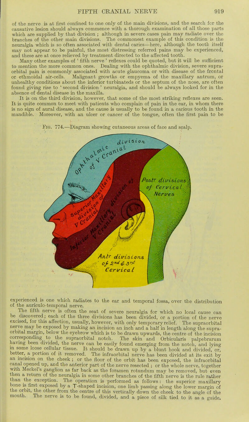 of the nerve is at first confined to one only of the main divisions, and the search for the causative lesion should always commence with a thorough examination of all those parts which are supplied by that division ; although in severe cases pain may radiate over the branches of the other main divisions. The commonest example of this condition is the neuralgia which is so often associated with dental caries—here, although the tooth itself may not appear to be painful, the most distressing referred pains may be experienced, and these are at once relieved by treatment directed to the aSected tooth. Many other examples of ' fifth nerve ' reflexes could be quoted, but it will be sufficient to mention the more common ones. Dealing with the ophthalmic division, severe supra- orbital pain is commonly associated with acute glaucoma or with disease of the frontal or ethmoidal air-cells. Malignant growths or empyema of the maxillary antrum, or imhealthy conditions about the inferior turbinateds or the septum of the nose, are often found giving rise to ' second division ' neuralgia, and should be always looked for in the absence of dental disease in the maxUIa. It is on the third division, however, that some of the most striking reflexes are seen. It is quite common to meet with patients who complain of pain in the ear, in whom there is no sign of aural disease, and the cause is usually to be found in a carious tooth in the mandible. Moreover, with an ulcer or cancer of the tongue, often the first pain to be jB^g. 774.—Diagram showing cutaneous areas of face and spalp. experienced is one which radiates to the ear and temporal fossa, over the distribution of the auriculo-temporal nerve. The fifth nerve is often the seat of severe neuralgia for which no local cause can be discovered; each of the three divisions has been divided, or a portion of the nerve excised, for this affection, usually, however, with only temporary relief. The supraorbital nerve may be exposed by making an incision an inch and a half m length along the supra- orbital margin, below the eyebrow which is to be drawn upwards, the centre of the incision corresponding to the supraorbital notch. The skin and Orbicularis palpebrarum havmg been divided, the nerve can be easily found emerging from the notch, and lying in some loose cellular tissue. It should be drawn up by a blunt hook and divided, or, better, a portion of it removed. The infraorbital nerve has been divided at its exit by an mcision on the cheek ; or the floor of the orbit has been exposed, the infraorbital ^'^^ u ivT^^ > ^^ anterior part of the nerve resected ; or the whole nerve, together with Meckel's ganglion as far back as the foramen rotundum may be removed, but even then a return of the neuralgia in some other branches of the fifth nerve is the rule rather than the exception. The operation is performed as follows : the superior maxillary bone is first exposed by a T-shaped incision, one limb passing along the lower margin of the orbit, the other from the centre of this vertically down the cheek to the angle of the mouth. The nerve is to be found, divided, and a piece of silk tied to it as a uide.