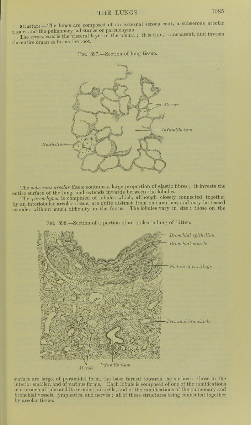 structure.—The lungs are composed of an external serous coat, a subserous areolar tissue, and the pulmonary substance or parenchyma. ^ j • The serous coat is the visceral layer of the pleura ; it is thm, transparent, and invests the entu-e organ as far as the root. Fig. 897.—Section of lung tissue. Epithelium llveoK ^ InfunAihtiluin The subserous areolar tissue contains a large proportion of elastic fibres ; it invests the entire sm-face of the lung, and extends inwards between the lobules. The parenchyma is composed of lobules which, although closely connected together by an interlobular areolar tissue, are quite distinct from one another, and may be teased asunder without much difaculty in the foetus. The lobules vary in size : those on the Fig. 898.—Section of a portion of an ateleotio lung of kitten, |t.^^*/.^fl':.if)^J^ Bronchial epitheliia, , : '  ■ s , ;. Bronchial muscle Nodule of cartilage • Terminal bronchiole Alveoli Tnfundibulum surface are large, of pyramidal form, the base turned towards the surface ; those in tlie interior smaller, and of various forms. Each lobule is composed of one of the ramifications of a broncliial tube and its terminal aii--cells, and of the ramifications of the pulmonary and bronchial vessels, lymphatics, and nerves ; all of these structures being connected together by areolar ti.ssue.