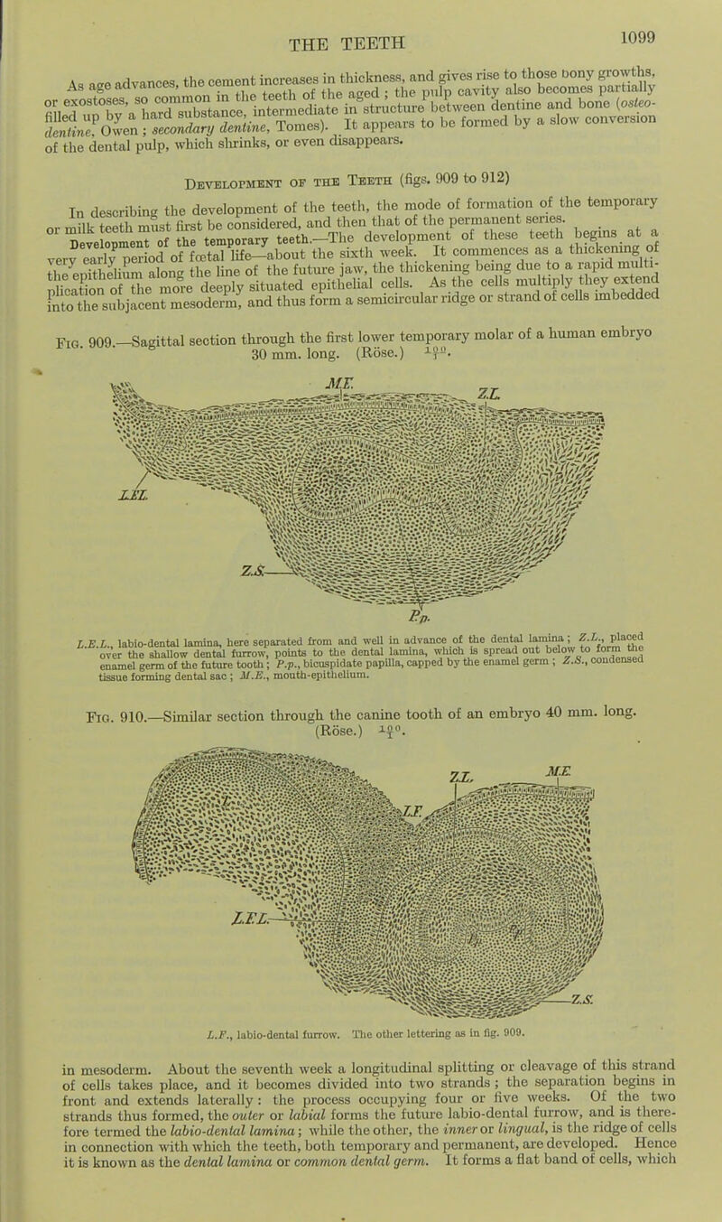 As age advances, thecementin™ of the dental pulp, which shrinks, or even disappears. Development of the Teeth (figs. 909 to 912) In describing the development of the teeth, the mode of formation of the temporary •n f^^fl, Tvin,*- fircii- be considered, and then that of the permanent series, ''^ve oplenTof Se^ t development of these teeth begins at a verfearlyTeHod of fa>tal life-abo^ the sixth week. It commences as a thickening of SpUhelium a ong the line of the future jaw, the thickemng being due to a rapid multi- nlTcXn of the more deeply situated epithelial cells. As the cells multiply they extend FShe subjacen^^^esoderm, and thus form a semicircular ridge or strand of cells mibedded Fig 909 -Sagittal section through the first lower temporary molar of a human embryo 30 mm. long. (Rose.) J-^. L.E.L., labio-dentel lamina, here separated from and weU m advance of the dental l^inna ^ i., placed over the shaUow dental fmrow, points to the dental lamina, which is spread out below to form the enamel germ of the future tooth; P.p., bicuspidate papUla, capped by the enamel germ ; Z.S., oonaenaea tissue forming dental sac ; M.E., mouth-epithehum. Fig. 910.—Similar section through the canine tooth of an embryo 40 mm. long, (Rose.) L.F., labio-dental furrow. Tlie other lettering as in fig. 909. in mesoderm. About the seventh week a longitudinal splitting or cleavage of this strand of cells takes place, and it becomes divided uito two strands ; the separation begins in front and extends laterally : the process occupying four or five weeks. Of the two strands thus formed, the cmter or labial forms the futme labio-dental furrow, and is there- fore termed the labio-dental lamina; while the other, the inner ox lingual, is the ridge of cells in connection with which the teeth, both temporary and permanent, are developed. Hence it is known as the dental lamina or common dental germ. It forms a flat band of cells, which