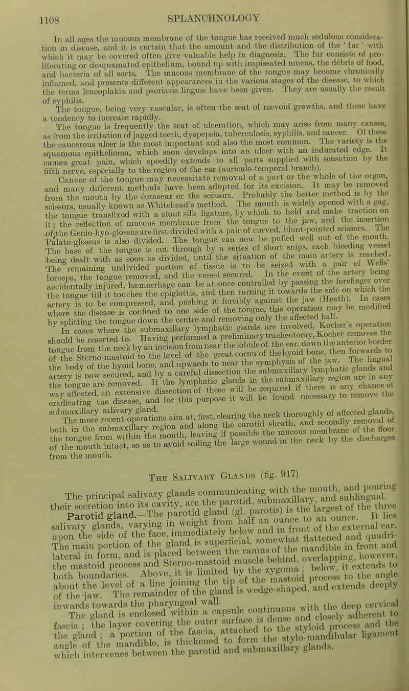 In all ages the mucous membrane of the tongue has received much sedulous considera- tion in disease, and it is certain that the amount and the distribution of the ' fur' with which it may be covered often give valuable help in diagnosis. The fm' consists of lao- liferating or desquamated epithelium, bound up with insi)i8sated mucus, the debris of food, and bacteria of all sorts. The mucous membrane of the tongue may Ijecome chronically inflamed, and presents different appearances in the various stages of the disease, to which the terms leucoplakia and psoriasis lingua; have been given. They are usually the result ^The^ongue, being very vascular, is often the seat of najvoid growths, and these have a tendency to increase rapidly. _ The tongue is frequently the seat of ulceration, which may arise from many causes, as from the irritation of jagged teeth, dyspepsia, tuberculosis, syphilis, and cancer. Of these the cancerous ulcer is the most important and also the most common. The variety is the squamous epitheUoma, which soon develops into an ulcer with an indurated edge, it causes great pain, which speedily extends to all parts supphed wth seasation by the fifth nerve, especially to the region of the ear (amiculo-temporal branch). Cancer of the tongue may necessitate removal of a part or the whole of the organ and many different methods have been adopted for its excision. It may be removed from the mouth by the ecraseur or the scissors. Probably the better method is by the scissors, usually known as Whitehead's method. The mouth is \videly opened with a gag, the tongue transfixed with a stout silk ligatui-e, by which to hold and make traction on it; the reflection of mucous membrane from the tongue to the jaw, and the insertion of the Genio-hyo-glossusarefest divided with a paii' of '=f^ed, blunt.pomted scissors^ The Palato-glossus is also divided. The tongue can now be pulled well out of tjie mouth The bale of the tongue is cut through by a series of short smps, each bleeding vessel ,;Sng dealt with as soon as divided, until the situation of the mam arte^-J' is reached. •The remaining undivided portion of tissue is to be seized ^nth a paii of Wells forceps thTtongue removed, and the vessel secured. In the event of the artery being accidentally infZd, haemorrhage can be at once controlled by passing the forefinger over tS tong^e\m\t torches the epiglottis, and then tm-ning it f-rds he side on w^ch^h artery fs to be compressed, and pushing it forcibly against the jaw (Heath In case where the disease is confined to one side of the tongue t\m of^eratoon may be modihed bv shutting the tongue down the centre and removmg only the agected halt. ^^ rSs where'the submaxillary lymphatic glands are ^^^f^^'l^^^^^^^^^^^^ bout in the s,,bmaxill.t.y region and along S'''', *~*i„°le^^^^ o7Tl,e floor from the mouth. The Salivary Glands (fig. 917) The principal salivary glands -mmumcj^i.^ jvitl^^^ their secretion into its cavity, are ^Jj^ 1^ ° of the three Parotid gland.-The parotid f ^'J; '^^^^^^^^ announce. It lies salivary glands, varying m ^^eigl}t f'oni halt .^^^^^^ upon tlie side of the face, immeduately be o ^ ^^^^^^^ .^„d c,uadri- The main portion of the gland is ^'^P^^^^^^l-^^^'^^ in front and lateral in form, and is placed between the i^' ^^^^^^^ veSappine, however, the mastoid process and Sterno-mastoKl ^f Slow it extends to both boundaries. Above, it is l;ted by th^ zygo'^^^^ bel fascia ; tlie layer covering the ou er Je ^,^e ^ the tlie gUnd ; a portion of the fascia attached « « ^ ^^^l,,,!,, li.anuMit