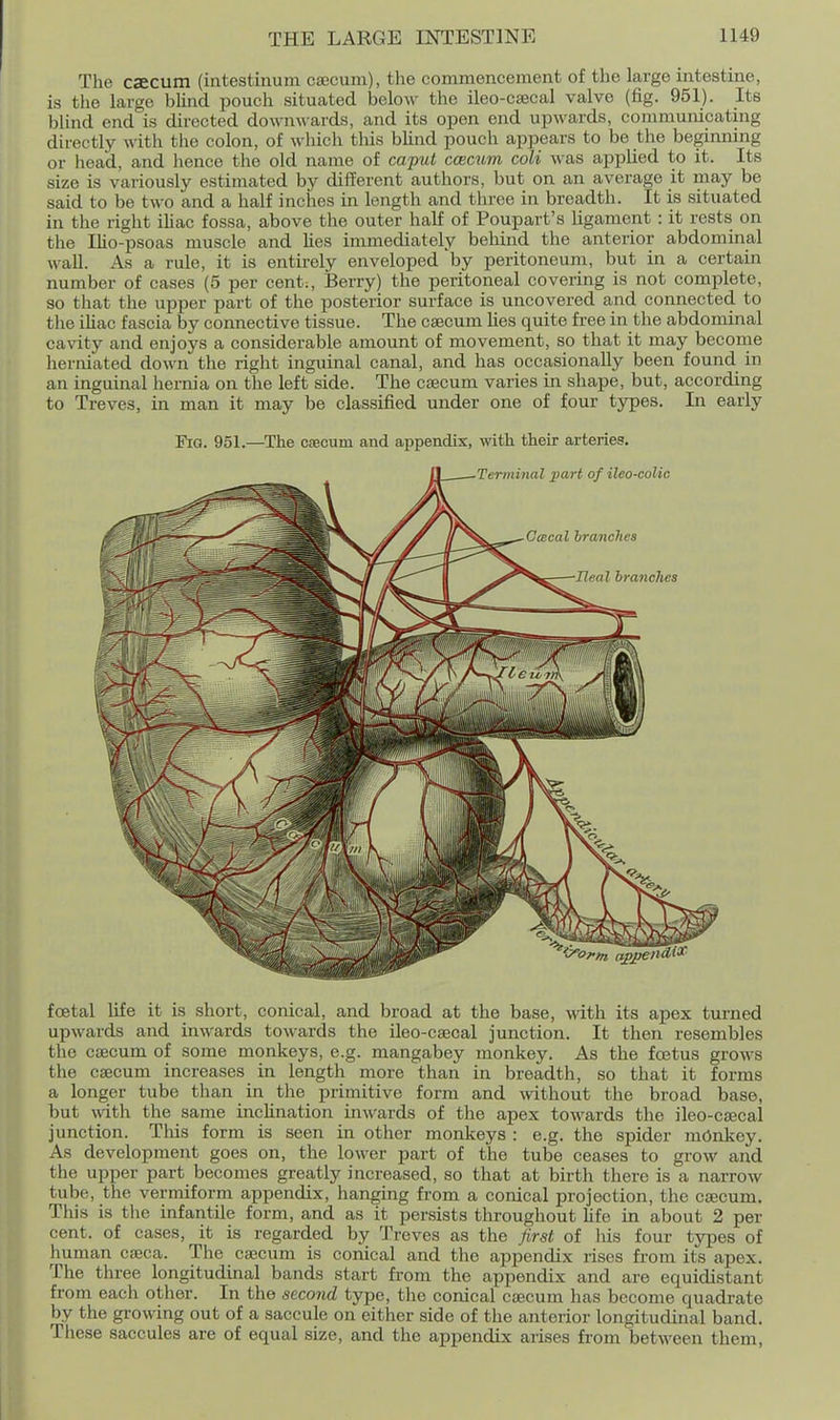 The cjecum (intestinum ca3cum), the commencement of the large intesthae, is the large blind pouch situated below the ileo-csecal valve (fig. 951). Its blind end is directed downwards, and its open end upwards, communicating directly with the colon, of which this blind pouch appears to be the beginning or head, and hence the old name of cafut ccecum coli was applied to it. Its size is variously estimated by different authors, but on an average it may be said to be two and a half inches in length and three in breadth. It is situated in the right iliac fossa, above the outer half of Poupart's ligament : it rests on the Ilio-psoas muscle and lies immediately behind the anterior abdominal wall. As a rule, it is entirely enveloped by peritoneum, but in a certain number of cases (5 per cent;, Berry) the peritoneal covering is not complete, so that the upper part of the posterior surface is uncovered and connected to the iliac fascia by connective tissue. The caecum lies quite free in the abdominal cavity and enjoys a considerable amount of movement, so that it may become herniated down the right inguinal canal, and has occasionally been found in an inguinal hernia on the left side. The caecum varies in shape, but, according to Treves, in man it may be classified under one of four types. In early Fig. 951.—The cfecum and appendix, with their arteries. foetal life it is short, conical, and broad at the base, with its apex turned upwards and inwards towards the ileo-caecal junction. It then resembles the caecum of some monkeys, e.g. mangabey monkey. As the fcetus grows the caecum increases in length more than in breadth, so that it forms a longer tube than in the primitive form and without the broad base, but with the same inclination inwards of the apex towards the ileo-caecal junction. This form is seen in other monkeys : e.g. the spider mdnkey. As development goes on, the lower part of the tube ceases to grow and the upper part becomes greatly increased, so that at birth there is a narrow tube, the vermiform appendix, hanging from a conical projection, the caecum. Tliis is the infantile form, and as it persists throughout life in about 2 per cent, of cases, it is regarded by Treves as the first of liis four types of human caeca. The caecum is conical and the appendix rises from its apex. The three longitudinal bands start from the appendix and are equidistant from each other. In the seco7id type, the conical caecum has become quadrate by the growing out of a saccule on either side of the anterior longitudinal band. These saccules are of equal size, and the appendix arises from between them.