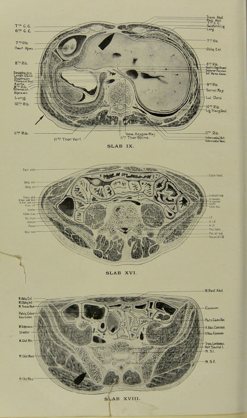 6™ C.C. S|3lean Lunjg. 10™ Rib. II™ Rib. .Tr*.n» Abd Rut. Abd TVC c IITI1 Thor Vert ■lOT Rib Li4Tri».nJJ)«xl Jr Rib Inlercost&IArt. InUrcofiUiVam. SLAB IX. Colon rrans SLAB XVI. M Red Abd HOUiqll) MObli<).lnt- M.TrjimAbd^ Pelvic Cojoir IliMColon Ureter - M.GIul lllin M OlulMed.-Vr-™ \1 SX^AB XVIII. 1