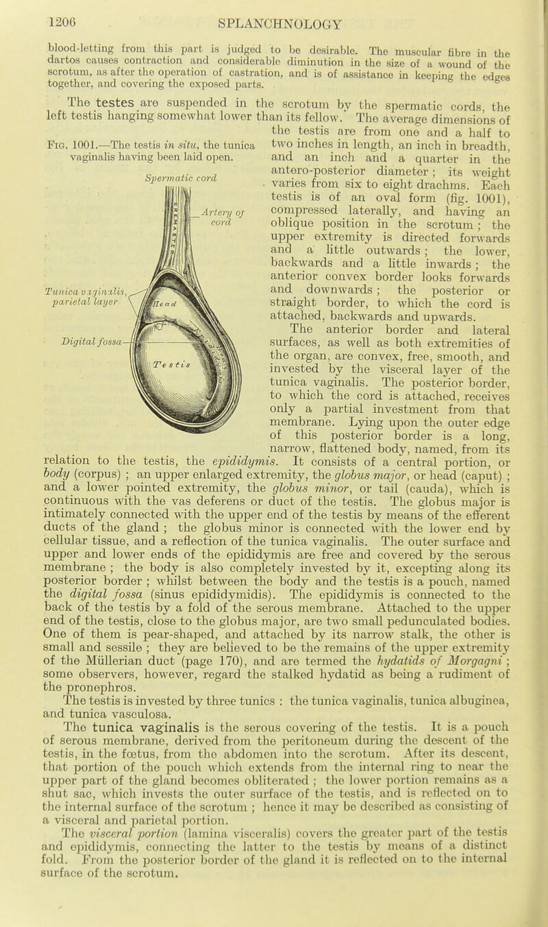 Fig. 1001.—The testis in situ, the tunica vaginahs having been laid open. Si^ermatic cord Artery of cord Tunica v%jliialis, parietal layer Digital fossa blood-letting from this part is judged to be desirable. The muscular fibre in the dartos causes contraction and considerable diminution in the size of a wound of the scrotum, as after the operation of castration, and is of assistance in keeping the edges together, and covering the exposed parts. The testes are suspended in the scrotum by the spermatic cords the left testis hanging somewhat lower than its fellow. The average dimensions of the testis are from one and a half to two inches in length, an inch in breadth, and an inch and a quarter in the antero-posterior diameter; its weight varies from six to eight drachms. Each testis is of an oval form (fig. 1001), compressed laterally, and having an oblique position in the scrotum ; the upper extremity is directed forwards and a little outwards ; the lower, backwards and a httle inwards ; the anterior convex border looks forwards and downwards ; the posterior or straight border, to which the cord is attached, backwards and upwards. The anterior border and lateral surfaces, as well as both extremities of the organ, are convex, free, smooth, and invested by the visceral layer of the tunica vaginalis. The posterior border, to which the cord is attached, receives only a partial investment from that membrane. Lying upon the outer edge of this posterior border is a long, narrow, flattened body, named, from its relation to the testis, the epididymis. It consists of a central portion, or body (corpus) ; an upper enlarged extremity, the globus major, or head (caput) ; and a lower pointed extremity, the globus minor, or tail (cauda), which is continuous with the vas deferens or duct of the testis. The globus major is intimately connected with the upper end of the testis by means of the efferent ducts of the gland ; the globus minor is connected \\4th the lower end by cellular tissue, and a reflection of the tunica vaginalis. The outer surface and upper and lower ends of the ej)ididymis are free and covered by the serous membrane ; the body is also completely invested by it, excepting along its posterior border ; whjlst between the body and the testis is a pouch, named the digital fossa (sinus epididymidis). The epididymis is comaected to the back of the testis by a fold of the serous membrane. Attached to the ujiper end of the testis, close to the globus major, are two small pedunculated bodies. One of them is pear-shaped, and attached by its narrow stalk, the other is small and sessile ; they are believed to be the remains of the upper extremity of the Miillerian duct (page 170), and are termed the hydatids of Morgagni ; some observers, however, regard the stalked hydatid as bemg a rudiment of the pronephros. The testis is invested by three tunics : the tunica vaginalis, tunica albuginea, and tunica vasculosa. The tunica vaginalis is the serous covering of the testis. It is a pouch of serous membrane, derived from the peritoneum during the descent of the testis, in the foetus, from the abdomen into the scrotum. After its descent, that portion of the pouch which extends from the internal ring to near the upper part of the gland becomes obliterated ; the lower portion remains as a shut sac, which invests the outer surface of the testis, and is reflected on to the internal surface of the scrotum ; hence it may be described as consisting of a visceral and parietal portion. The visceral portion (lamina visceralis) covers the greater part of the testis and epididymis, connecting the latter to tlie testis by means of a distinct fold. From the posterior border of the gland it is reflected on to the internal surface of the scrotum.