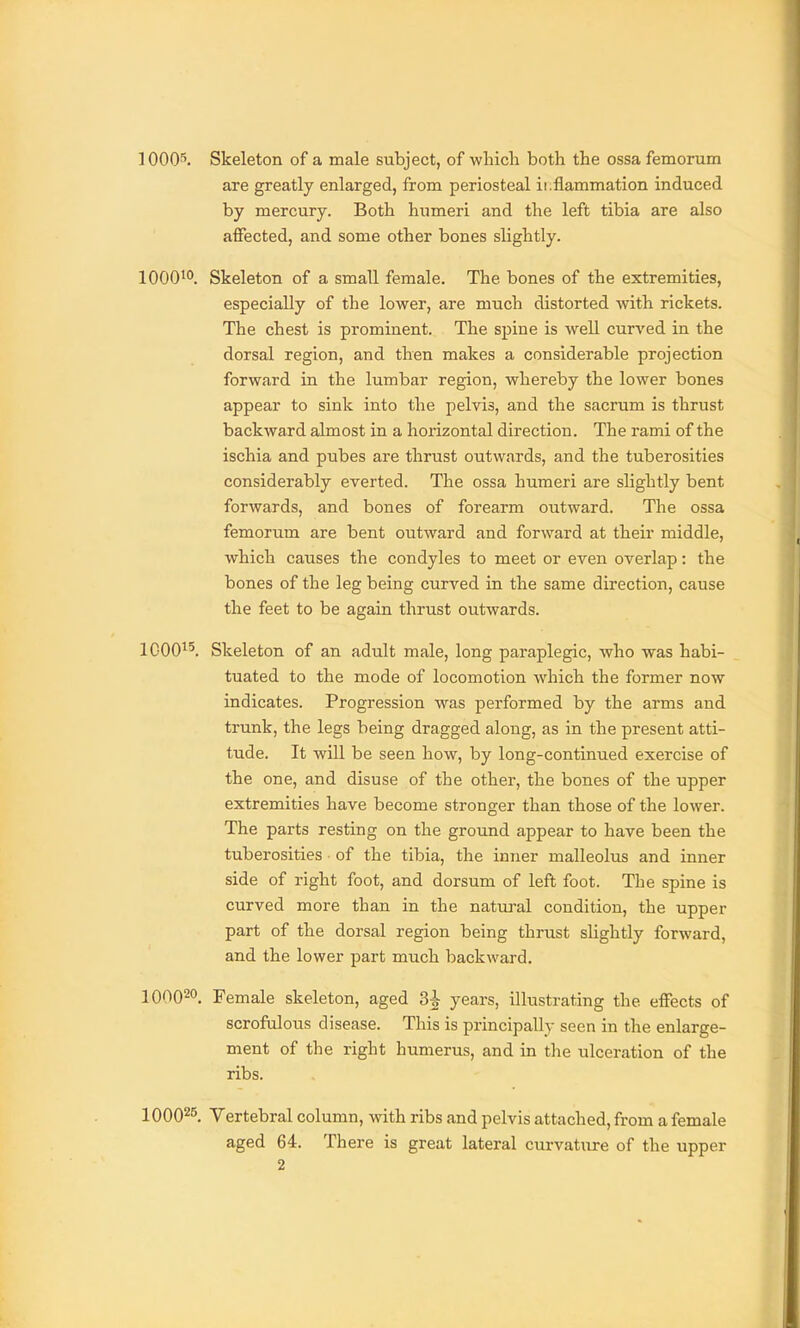10005. Skeleton of a male subject, of wlncli both the ossa femorum are greatly enlarged, from periosteal ii;flammation induced by mercury. Both humeri and the left tibia are also affected, and some other bones slightly. 1000^°. Skeleton of a small female. The bones of the extremities, especially of the lower, are much distorted with rickets. The chest is prominent. The spine is well curved in the dorsal region, and then makes a considerable projection forward in the lumbar region, whereby the lower bones appear to sink into the pelvis, and the sacrum is thrust backward almost in a horizontal direction. The rami of the ischia and pubes are thrust outwards, and the tuberosities considerably everted. The ossa humeri are slightly bent forwards, and bones of forearm outward. The ossa femorum are bent outward and forward at their middle, which causes the condyles to meet or even overlap: the bones of the leg being curved in the same direction, cause the feet to be again thrust outwards. 1000^5. Skeleton of an adult male, long paraplegic, who was habi- tuated to the mode of locomotion which the former now indicates. Progression was performed by the arms and trunk, the legs being dragged along, as in the present atti- tude. It will be seen how, by long-continued exercise of the one, and disuse of the other, the bones of the upper extremities have become stronger than those of the lower. The parts resting on the ground appear to have been the tuberosities of the tibia, the inner malleolus and inner side of right foot, and dorsum of left foot. The spine is curved more than in the natural condition, the upper part of the dorsal region being thrust slightly forward, and the lower part much backward. 100020. Female skeleton, aged 3^ years, illustrating the effects of scrofulous disease. This is principally seen in the enlarge- ment of the right humerus, and in the ulceration of the ribs. 100025 Vertebral column, with ribs and pelvis attached, from a female aged 64. There is great lateral curvature of the upper