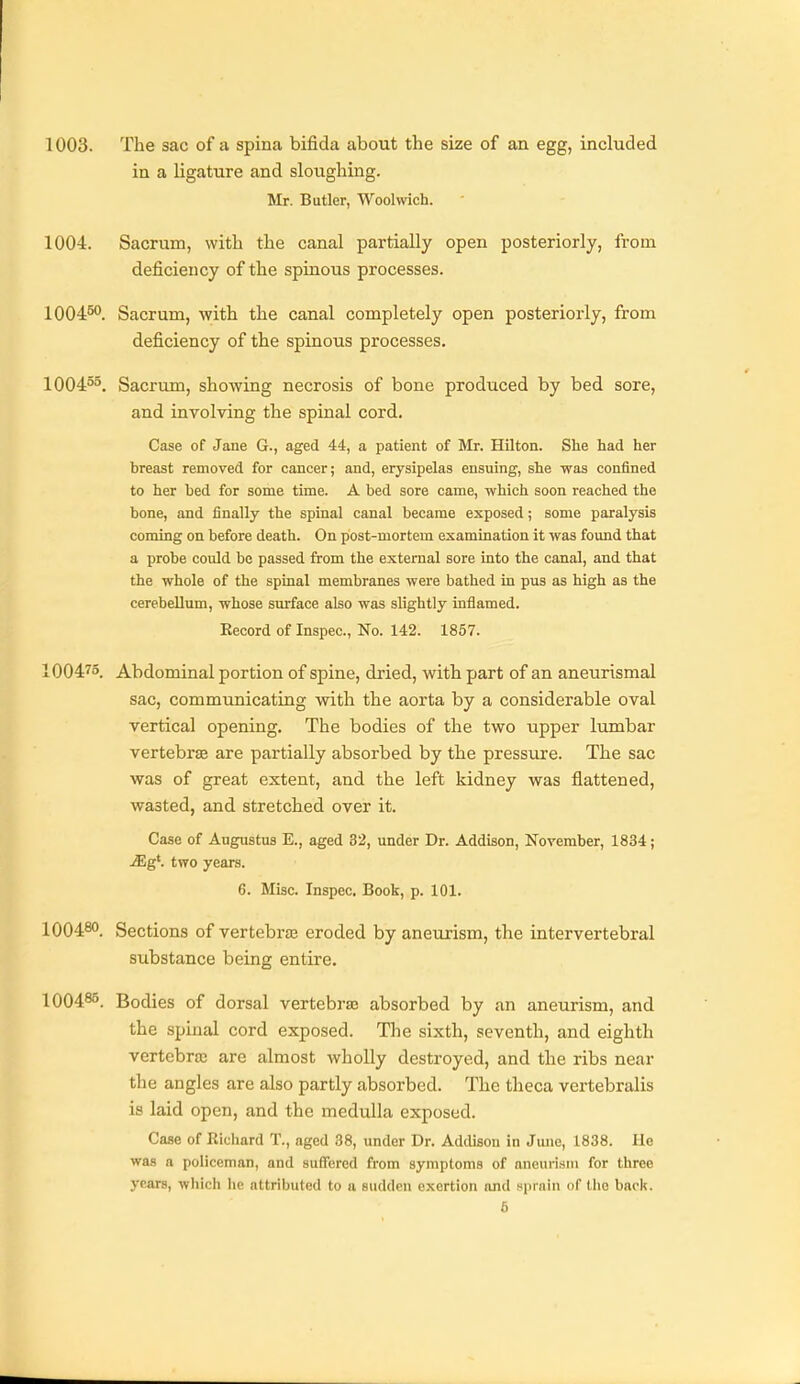 1003. The sac of a spina bifida about the size of an egg, included in a ligature and sloughing. Mr. Butler, Woolwich. 1004. Sacrum, with the canal partially open posteriorly, from deficiency of the spinous processes. 10045. Sacrum, with the canal completely open posteriorly, from deficiency of the spinous processes. 1004°^ Sacrum, showing necrosis of bone produced by bed sore, and involving the spinal cord. Case of Jane G., aged 44, a patient of Mr. Hilton. She had her breast removed for cancer; and, erysipelas ensuing, she was confined to her bed for some time. A bed sore came, which soon reached the bone, and finally the spinal canal became exposed; some paralysis coming on before death. On post-mortem examination it was found that a probe could be passed from the external sore into the canal, and that the whole of the spinal membranes were bathed in pus as high as the cerebellum, whose surface also was slightly inflamed. Kecord of Inspec, No. 142. 1857. 100475. Abdominal portion of spine, dried, with part of an aneurismal sac, communicating with the aorta by a considerable oval vertical opening. The bodies of the two upper lumbar vertebrae are partially absorbed by the pressure. The sac was of great extent, and the left kidney was flattened, wasted, and stretched over it. Case of Augustus E., aged 32, under Dr. Addison, November, 1834; jEg'. two years. 6. Misc. Inspec. Book, p. 101. IOO480. Sections of vertebras eroded by aneurism, the intervertebral substance being entire. 1004^5. Bodies of dorsal vertebra; absorbed by an aneurism, and the spinal cord exposed. The sixth, seventh, and eighth vertebras are almost wholly destroyed, and the ribs near the angles are also partly absorbed. The theca vertebralis is laid open, and the medulla exposed. Case of Ricliard T., aged 38, under Dr. Addison in June, 1838. He was a policeman, and suffered from symptoms of aneurism for three years, which he attributed to a sudden exertion and sprniii (if tlio back.