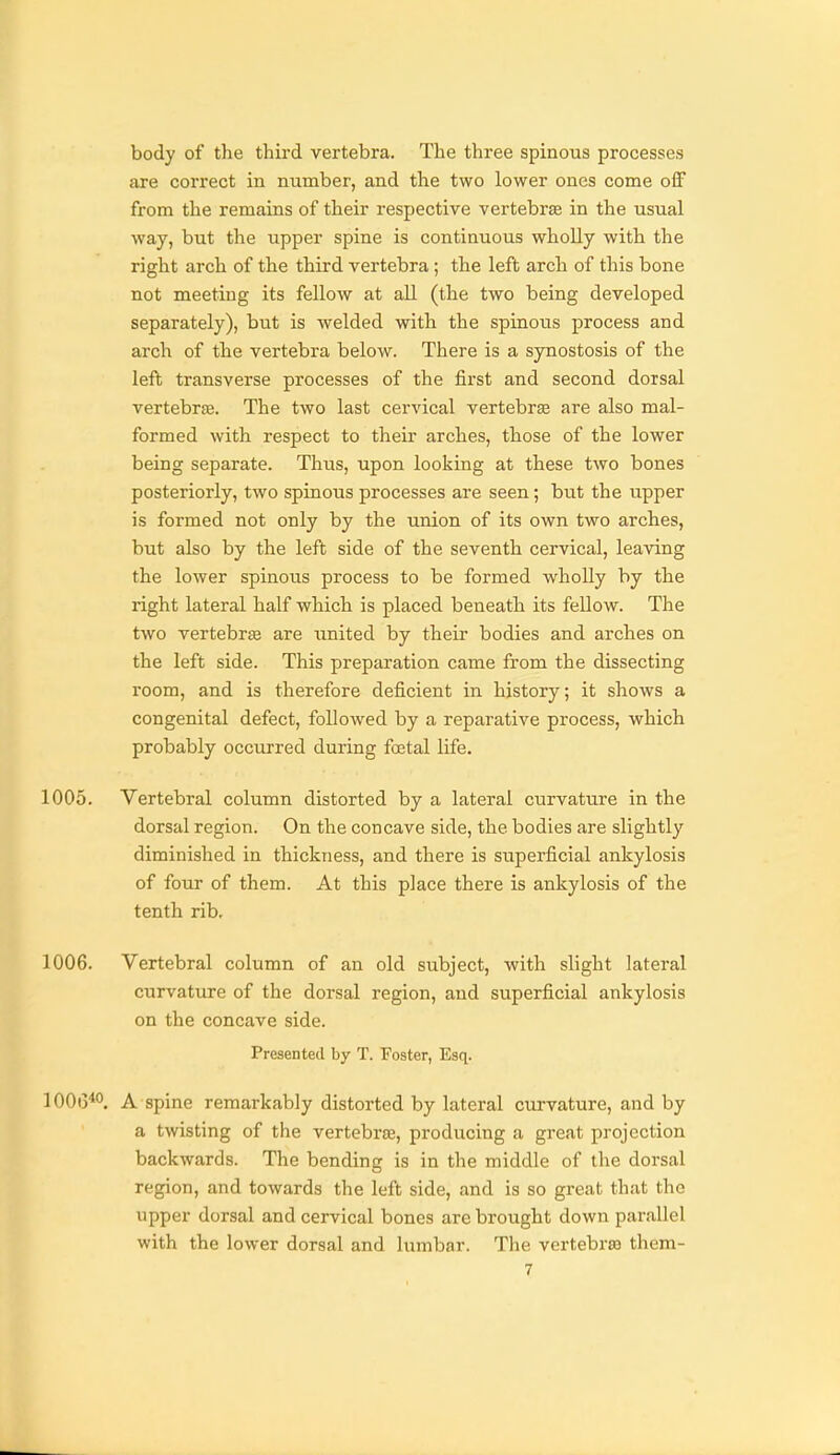 body of the third vertebra. The three spinous processes are correct in number, and the two lower ones come off from the remains of their respective vertebrae in the usual way, but the upper spine is continuous whoUy with the right arch of the third vertebra; the left arch of this bone not meeting its fellow at all (the two being developed separately), but is welded with the spinous process and arch of the vertebra below. There is a synostosis of the left transverse processes of the first and second dorsal vertebrae. The two last cervical vertebrae are also mal- formed with respect to their arches, those of the lower being separate. Thus, upon looking at these two bones posteriorly, two spinous processes are seen; but the upper is formed not only by the union of its own two arches, but also by the left side of the seventh cervical, leaving the lower spinous process to be formed wholly by the right lateral half which is placed beneath its fellow. The two vertebra are united by their bodies and arches on the left side. This preparation came from the dissecting room, and is therefore deficient in history; it shows a congenital defect, followed by a reparative process, which probably occurred during foetal life. 1005. Vertebral column distorted by a lateral curvature in the dorsal region. On the concave side, the bodies are slightly diminished in thickness, and there is superficial ankylosis of foiu of them. At this place there is ankylosis of the tenth rib, 1006. Vertebral column of an old subject, with slight lateral curvature of the dorsal region, and superficial ankylosis on the concave side. Presented by T. Foster, Esq. 100(3^0 A spine remarkably distorted by lateral curvature, and by a twisting of the vertebr£B, producing a great projection backwards. The bending is in the middle of the dorsal region, and towards the left side, and is so great that the upper dorsal and cervical bones are brought down parallel with the lower dorsal and lumbar. The vertebrsa them-