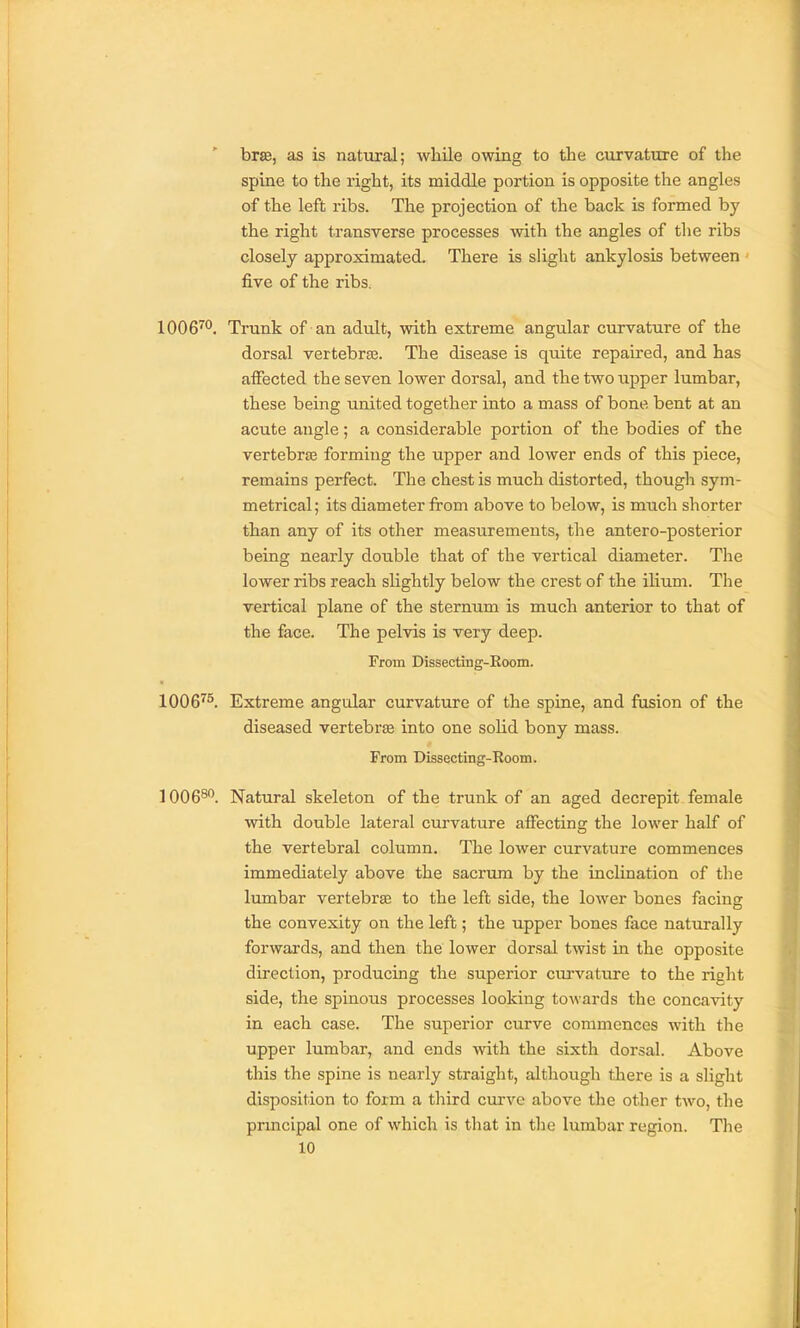 brae, as is natural; wliile owing to the curvature of the spine to the right, its middle portion is opposite the angles of the left ribs. The projection of the back is formed by the right transverse processes with the angles of the ribs closely approximated. There is slight ankylosis between five of the ribs. Trunk of an adult, with extreme angular curvature of the dorsal vertebree. The disease is quite repaired, and has affected the seven lower dorsal, and the two upper lumbar, these being united together into a mass of bone bent at an acute angle; a considerable portion of the bodies of the vertebraj forming the upper and lower ends of this piece, remains perfect. The chest is much distorted, though sym- metrical ; its diameter from above to below, is much shorter than any of its other measurements, the antero-posterior being nearly double that of the vertical diameter. The lower ribs reach slightly below the crest of the ilium. The vertical plane of the sternum is much anterior to that of the face. The pelvis is very deep. From Dissecting-Room. 1006''^. Extreme angular curvature of the spine, and fusion of the diseased vertebrae into one solid bony mass. From Dissecting-Room. 1006^'^. Natural skeleton of the trunk of an aged decrepit female with double lateral curvature affecting the lower half of the vertebral column. The lower curvature commences immediately above the sacrum by the inclination of the lumbar vertebrae to the left side, the lower bones facing the convexity on the left; the upper bones face naturally forwards, and then the lower dorsal twist in the opposite direction, producing the superior cm'vature to the right side, the spinous processes looking towards the concavity in each case. The superior curve commences with the upper lumbar, and ends with the sixth dorsal. Above this the spine is nearly straight, although there is a slight disposition to form a third curve above the other two, the prmcipal one of which is that in the lumbar region. The