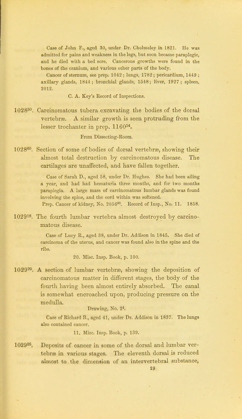 Case of John F., aged 30, under Dr. Cholmeley in 1821. He was admitted for pains and weakness in the legs, but soon became paraplegic, and he died with a bed sore. Cancerous growths were found in the bones of the cranium, and various other parts of the body. Cancer of sternum, see prep. 1042 ; lungs, 1782; pericardium, 1449 ; axillaiy glands, 1844 ; bronchial glands, 1548; liver, 1927 ; spleen, 2012. C. A. Key's Record of Inspections. 1028^°. Carcinomatous tubera excavating the bodies of the dorsal vertebrae. A similar growth is seen protruding from the lesser trochanter in prep. 1160^*. From Dissecting-Room. 1028^. Section of some of bodies of dorsal vertebras, showing their almost total destruction by carcinomatous disease. The cartilages are unaffected, and have fallen together. Case of Sarah D., aged 58, under Dr. Hiighes. She had been ailing a year, and had had hematuria three months, and for two months paraplegia. A large mass of carcinomatous lumbar glands was found involving the spine, and the cord within was softened. Prep. Cancer of kidney. No. 2066™. Record of Insp., No. 11. 1858. IO2918. The fourth lumbar vertebra almost destroyed by carcino- matous disease. Case of Lucy R., aged 38, under Dr. Addison in 1845. She died of carcinoma of the uterus, and cancer was found also in the spine and the ribs. 20. Misc. Insp. Book, p. 100. 1029^. A section of lumbar vertebrae, showing the deposition of carcinomatous matter in different stages, the body of the fourth liaving been almost entirely absorbed. The canal is somewhat encroached upon, producing pressure on the medulla. Drawing, No. 2*. Case of Richard B., aged 41, under Dr. Addison in 1837. The lungs also contained cancer. 11. Misc. lasp. Book, p. 139. 102925, Deposits of cancer in some of the dorsal and lumbar ver- tebras in various stages. The eleventh dorsal is reduced almost to the dimension of an intervertebral substance, 28