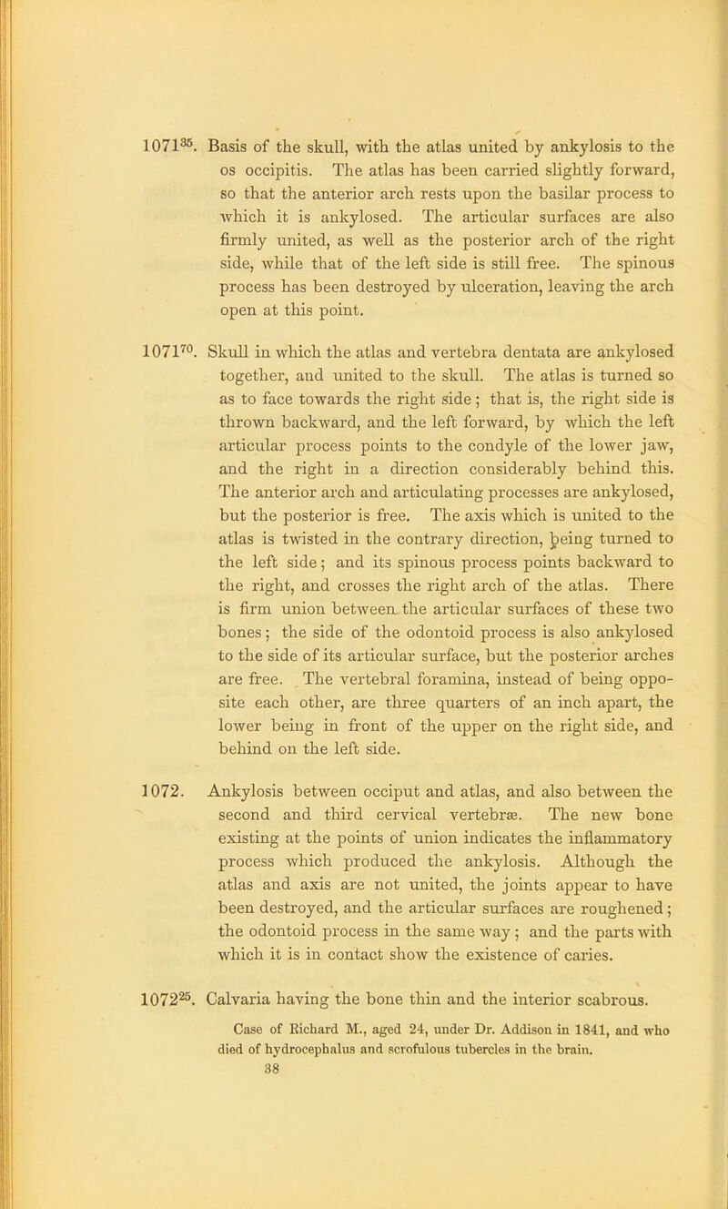 1071^^. Basis of the skull, with the atlas united by ankylosis to the OS occipitis. The atlas has been carried slightly forward, so that the anterior arch rests upon the basilar process to which it is ankylosed. The articular surfaces are also firmly united, as well as the posterior arch of the right side, while that of the left side is still free. The spinous process has been destroyed by ulceration, leaving the arch open at this point. 1071^. Skull in which the atlas and vertebra dentata are ankylosed together, and tmited to the skuU. The atlas is turned so as to face towards the right side; that is, the right side is thrown backward, and the left forward, by which the left articular process points to the condyle of the lower jaw, and the right in a direction considerably behind this. The anterior arch and articulating processes are ankylosed, but the posterior is free. The axis which is united to the atlas is twisted in the contrary direction, ^eing turned to the left side; and its spinous process points backward to the right, and crosses the right arch of the atlas. There is firm union between the articular surfaces of these two bones; the side of the odontoid process is also ankylosed to the side of its articular surface, but the posterior arches are free. The vertebral foramina, instead of being oppo- site each other, are three quarters of an inch apai't, the lower being in front of the upper on the right side, and behind on the left side. 1072. Ankylosis between occiput and atlas, and also between the second and third cervical vertebrse. The new bone existing at the points of union indicates the inflammatory process which produced the ankylosis. Although the atlas and axis are not united, the joints appear to have been destroyed, and the articular surfaces are roughened; the odontoid process in the same way ; and the parts with which it is in contact show the existence of caries. 1072^. Calvaria having the bone thin and the interior scabrous. Case of Richard M., aged 24, under Dr. Addison in 1841, and who died of hydrocephalus and scrofulous tubercles in the brain.