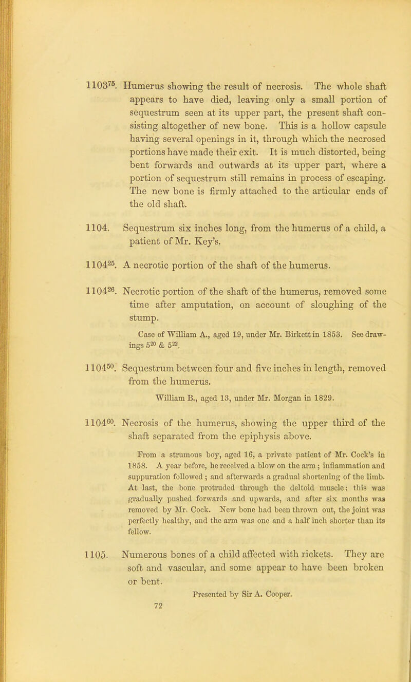 1103^^. Humerus showing the result of necrosis. The whole shaft appears to have died, leaving only a small portion of sequestrum seen at its upper part, the present shaft con- sisting altogether of new bone. This is a hollow capsule having several openings in it, through which the necrosed portions have made their exit. It is much distorted, being bent forwards and outwards at its upper part, where a portion of sequestrum still remains in process of escaping. The new bone is firmly attached to the articular ends of the old shaft. 1104. Sequestrum six inches long, from the humerus of a child, a patient of Mr. Key's. 1104^^. A necrotic portion of the shaft of the humerus. 110428. Necrotic portion of the shaft of the humerus, removed some time after amputation, on account of sloughing of the stump. Case of William A., aged 19, under Mr. Birkett in 1853. See draw- ings 520 & 522. 1104^^. Sequestrum between four and five inches in length, removed from the humerus. William B., aged 13, under Mr. Morgan in 1829. 1104^0. Necrosis of the humerus, showing the upper third of the shaft separated from the epiphysis above. From a strumous boy, aged 16, a private patient of Mr. Cock's in 1858. A year before, he received a blow on the arm; inflammation and suppuration followed ; and afterwards a gradual shortening of the limb. At last, the bone protruded through the deltoid muscle; this was gradually pushed forwards and upwards, and after six months was removed by Mr. Cock. New bone had been throiATi out, the joint was perfectly healthy, and the arm was one and a half inch shorter than its fellow. 1105. Numerous bones of a child affected with rickets. They are soft and vascular, and some appear to have been broken or bent. Presented by Sir A. Cooper.