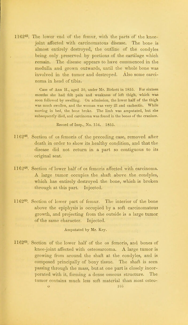 1102^5. The lower end of the femur, with the parts of the knee- joint alFected with carcinomatous disease. The bone is almost entirely destroyed, the outline of the condyles being only preserved by portions of the cartilage which remain. The disease appears to have commenced in the medulla and grown outwards, until the whole bone was involved in the tumor and destroyed. Also some carci- noma in head of tibia. Case of Ann H., aged 30, under Mr. Birkett in 1855. For sixteen months she had felt pain and weakness of left thigh, which was soon followed by swelluig. On admission, the lower half of the thigh was much swollen, and the woman was very ill and cachectic. While moving in bed, the bone broke. The limb was amputated, but she subsequently died, and carcinoma was found in the bones of the cranium. Record of Insp., No. 154, 1855. 1162*^. Section of os femoris of the preceding case, removed after death in order to show its healthy condition, and that the disease did not return in a part so contiguous to its original seat. 1162^^. Section of lower half of os femoris affected with carcinoma. A large tumor occupies the shaft above the condyles, which has entirely destroyed the bone, which is broken through at this part. Injected, 1162^. Section of lower part of femur. The interior of the bone above the epiphysis is occupied by a soft carcinomatous growth, and projecting from the outside is a large tumor of the same character. Injected. Amputated by Mr. Key. 1162^'^. Section of the lower half of the os femoris, and bones of knee-joint affected with osteosarcoma. A large tumor is growing from around the shaft at the condyles, and is composed principally of bony tissue. The shaft is seen passing through the mass, but at one part is closely incor- porated with it, forming a dense osseous structure. The tumor contains much less soft matei'ial than most osteo- O 10.7