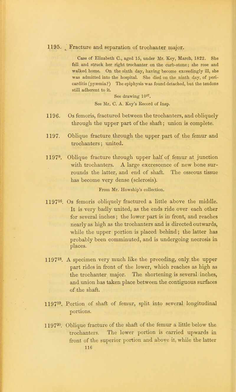 1196. ^ Fracture and separation of trochanter major. Case of Elizabeth C, aged 15, under Mr. Key, March, 1822. She fell and struck her right trochanter on the curb-stone; she rose and walked home. On the sixth day, having become exceedingly iU, she was admitted into the hospital. She died on the ninth day, of peri- carditis (pyaemia?) The epiphysis was found detached, but the tendons still adherent to it. See drawing 10. See Mr, C. A. Key's Kecord of Insp. 1196. Os femoris, fractured between the trochanters, and obliquely through the upper part of the shaft; union is complete. 1197. Oblique fracture through the upper part of the femur and trochanters; united. 1197^. Oblique fracture through upper half of femur at junction with trochanters. A large excrescence of new bone sur- rounds the latter, and end of shaft. The osseous tissue has become very dense (sclerosis). From Mr. Howship's collection. 1197'^^. Os femoris obliquely fractured a little above the middle. It is very badly united, as the ends ride over each other for several inches; the lower part is in front, and reaches nearly as high as the trochanters and is directed outwards, while the upper portion is placed behind; the latter has probably been comminuted, and is undergoing necrosis in places. 1197^^. A specimen very much like the preceding, only the upper part rides in front of the lower, which reaches as high as the trochanter major. The shortening is several inches, and union has taken place between the contiguous surfaces of the shaft. 1197^®. Portion of shaft of femur, split into several longitudinal portions. 119720. Oblique fracture of the shaft of the femur a little below the trochanters. The lower portion is carried upwards in front of the superior portion and above it, while the latter