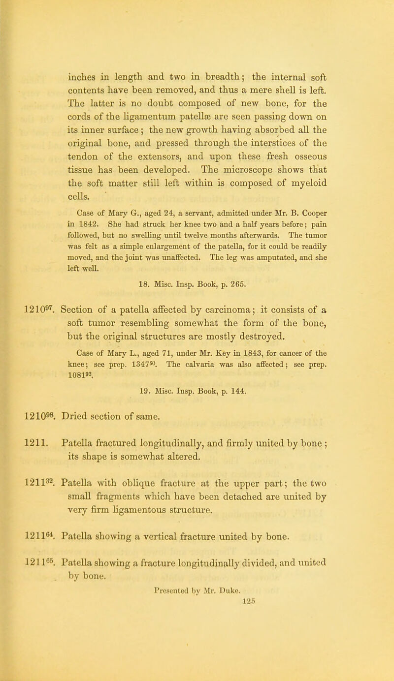 inches in length and two in breadth; the internal soft contents have been removed, and thus a mere shell is left. The latter is no doubt composed of new bone, for the cords of the ligamentum patellte are seen passing down on its inner surface ; the new growth having absorbed all the original bone, and pressed through the interstices of the tendon of the extensors, and upon these fresh osseous tissue has been developed. The microscope shows that the soft matter still left within is composed of myeloid cells. Case of Mary G., aged 24, a servant, admitted under Mr. B. Cooper in 1842. She had struck her knee two and a half years before; pain followed, but no swelling until twelve months afterwards. The tumor was felt as a simple enlargement of the patella, for it could be readily moved, and the joint was unaffected. The leg was amputated, and she left well. 18. Misc. Insp. Book, p. 266. 1210^. Section of a patella affected by carcinoma; it consists of a soft tumor resembling somewhat the form of the bone, but the original structures are mostly destroyed. Case of Mary L., aged 71, under Mr. Key in 1843, for cancer of the knee; see prep. 1347*0. The calvaria was also affected; see prep. 108193. 19. Misc. Insp. Book, p. 144. 1210^8. Dried section of same. 1211. Patella fractured longitudinally, and firmly united by bone; its shape is somewhat altered, 121132. Patella with oblique fracture at the upper part; the two amaU fragments which have been detached are united by very firm ligamentous structure. 121164. Patella showing a vertical fracture united by bone. 121165 Patella showing a fracture longitudinally divided, and united by bone. Prcsuiitcd by Mr. Duke. 12.')