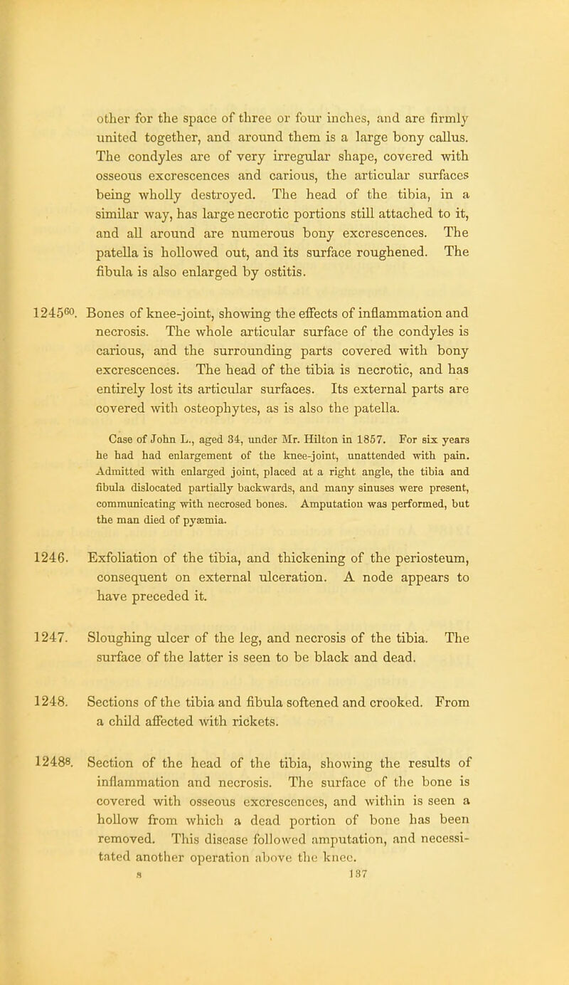 other for the space of three or four inches, and are firmly united together, and around them is a large bony callus. The condyles are of very irregular shape, covered with osseous excrescences and carious, the articular surfaces being wholly destroyed. The head of the tibia, in a similar way, has large necrotic portions still attached to it, and all around are numerous bony excrescences. The patella is hollowed out, and its surface roughened. The fibula is also enlarged by ostitis. 1245®'. Bones of knee-joint, showing the effects of inflammation and necrosis. The whole articular surface of the condyles is carious, and the surrounding parts covered with bony excrescences. The head of the tibia is necrotic, and has entirely lost its artictdar surfaces. Its external parts are covered vdth osteophytes, as is also the patella. Case of John L., aged 34, under Mr. Hilton in 1857. For six years he had had enlargement of the knee-joint, unattended with pain. Admitted with enlarged joint, placed at a right angle, the tibia and fibula dislocated partially backwards, and many sinuses were present, communicating with necrosed bones. Amputation was performed, but the man died of pyaemia. 1246. Exfoliation of the tibia, and thickening of the periosteum, consequent on external ulceration. A node appears to have preceded it. 1247. Sloughing ulcer of the leg, and necrosis of the tibia. The surface of the latter is seen to be black and dead. 1248. Sections of the tibia and fibula softened and crooked. From a child affected with rickets. 12488. Section of the head of the tibia, showing the results of inflammation and necrosis. The surface of the bone is covered with osseous excrescences, and within is seen a hoUow from which a dead portion of bone has been removed. This disease followed amputation, and necessi- tated another operation nbove the knee.