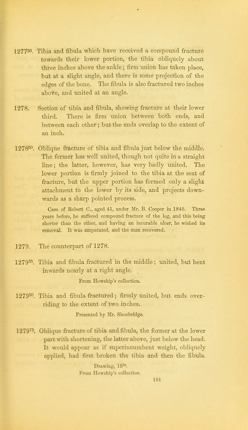 1277B0. Tibia and fibula which have received a compound fracture towards their lower portion, the tibia obliquely about three inches above the ankle; firm union has taken place, but at a slight angle, and there is some projection of the edges of the bone. The fibula is also fractured two inches above, and united at an angle. 1278. Section of tibia and fibula, shoAving fracture at their lower third. There is firm union between both ends, and between each other; but the ends overlap to the extent of an inch. 1278^°. Oblique fracture of tibia and fibula just below the middle. The former has well united, though not quite in a straight line; the latter, however, has very badly united. The lower portion is firmly joined to the tibia at the seat of fracture, but the upper portion has formed only a slight attachment to the lower by its side, and projects down- wards as a sharp pointed process. Case of Robert C, aged 41, under Mr. B. Cooper in 1840. Three years before, he suffered compound fracture of the leg, and this being shorter than the other, and having an incurable ulcer, he wished its removal. It was amputated, and the man recovered. 1279. The counterpart of 1278. 1279^. Tibia and fibula fractured in the middle; united, but bent inwards nearly at a right angle. From Howship's collection. 1279B0_ Tibia and fibula fractured; firmly united, but ends over- riding to the extent of two inches. Presented by Mr. Shoobridge. 1279^''. Oblique fracture of tibia and fibula, the former at the lower part with shortening, the latter above, just below the head. It would appear as if superincumbent weight, obliquely applied, had first broken the tibia and then the fibula. Drawing, 15. From Howship's collection.