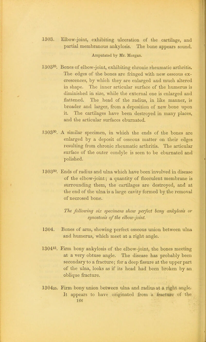1303. Elbow-joint, exhibiting ulceration of the cartilage, and partial membranous ankylosis. The bone appears sound. Amputated by Mr. Morgan. 1303^^. Bones of elbow-joint, exhibiting chronic rheumatic arthritis. The edges of the bones are fringed with new osseous ex- crescences, by which they are enlarged and much altered in shape. The inner articular surface of the humerus is diminished in size, while the external one is enlarged and flattened. The head of the radius, in like manner, is broader and larger, from a deposition of new bone upon it. The cartilages have been destroyed in many places, and the articular surfaces eburnated. 1303^. A similar specimen, in which the ends of the bones are enlarged by a deposit of osseous matter on their edges resulting from chronic rheumatic arthritis. The articular surface of the outer condyle is seen to be eburnated and polished. ] 303^*^. Ends of radius and ulna which have been involved in disease of the elbow-joint; a quantity of flocculent membrane is surrounding them, the cartilages are destroyed, and at the end of the ulna is a large cavity formed by the removal of necrosed bone. The following six specimens show perfect hony ankylosis or synostosis of the elbow-joint. 1304. Bones of arm, showing perfect osseous union between \ilna and humerus, which meet at a right angle. 130415. Firm bony ankylosis of the elbow-joint, the bones meeting at a very obtuse angle. The disease has probably been secondary to a fracture; for a deep fissure at the upper part of the ulna, looks as if its head had been broken by an oblique fracture. 130425. Firm bony union between ulna and radius at a right angle. It appears to have oi'iginated from a fractui-e of the