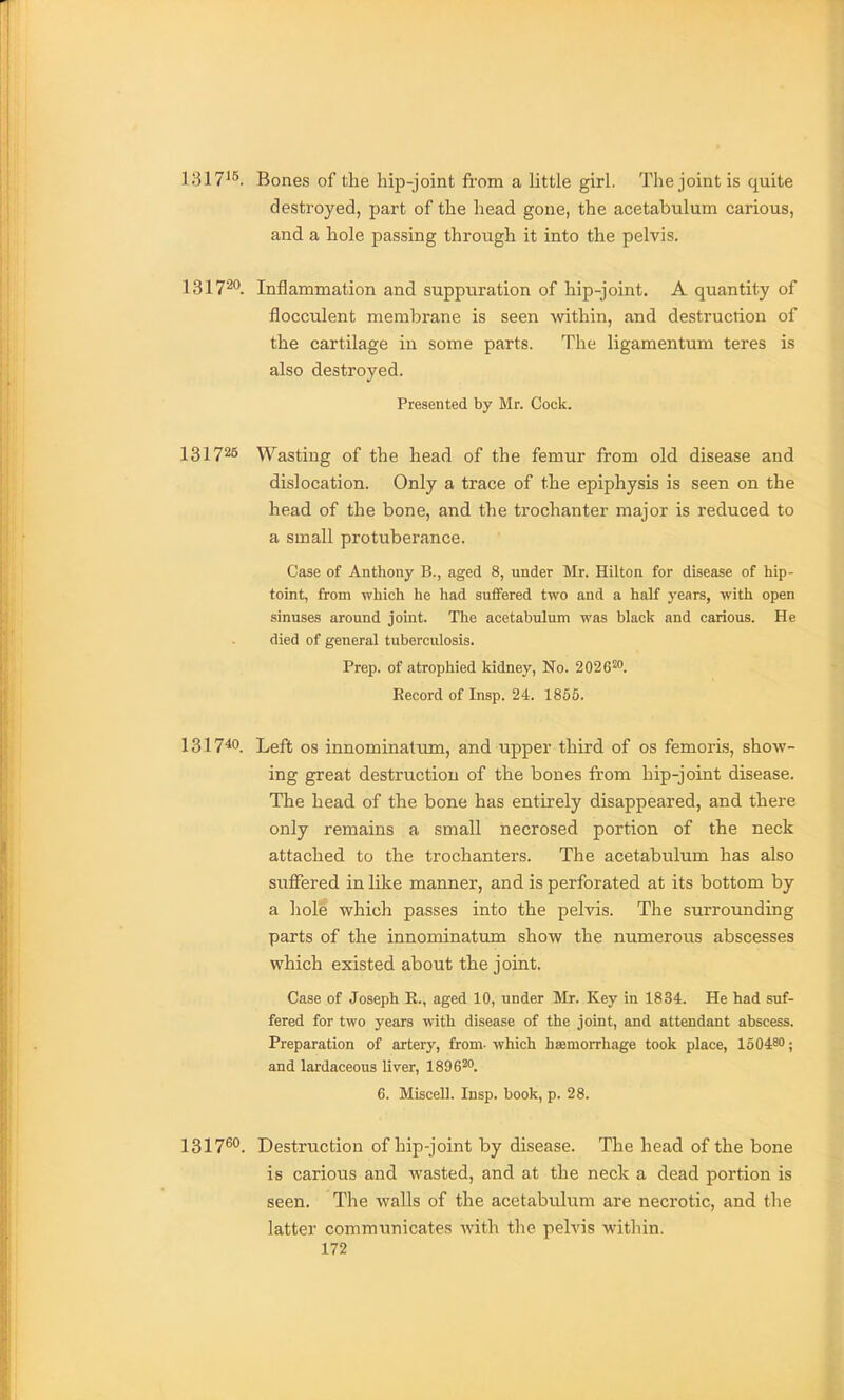 1317^^ Bones of the hip-joint fi-om a little girl. The joint is quite destroyed, part of the head gone, the acetabulum carious, and a hole passing through it into the pelvis. 131T^*'. Inflammation and suppuration of hip-joint. A quantity of flocculent membrane is seen within, and destruction of the cartilage in some parts. The ligamentum teres is also destroyed. Presented by Mr. Cock. 131725 Wasting of the head of the femur from old disease and dislocation. Only a trace of the epiphysis is seen on the head of the bone, and the trochanter major is reduced to a small protuberance. Case of Anthony B., aged 8, under Mr. Hilton for disease of hip- toint, from which he had suffered two and a half years, with open sinuses around joint. The acetabulum was black and carious. He died of general tuberculosis. Prep, of atrophied kidney, No. 2026^. Record of Insp. 24. 1855. 131740. Left OS innominatum, and upper third of os femoris, show- ing great destruction of the bones from hip-joint disease. The head of the bone has entirely disappeared, and there only remains a small necrosed portion of the neck attached to the trochanters. The acetabulum has also suffered in like manner, and is perforated at its bottom by a liole which passes into the pelvis. The surrounding parts of the innominatum show the numerous abscesses which existed about the joint. Case of Joseph R., aged 10, under Mr. Key in 1834. He had suf- fered for two years with disease of the joint, and attendant abscess. Preparation of artery, from- which haemorrhage took place, 150480; and lardaceous liver, 189620. 6. Miscell. Insp. book, p. 28. 1317^°. Destruction of hip-joint by disease. The head of the bone is carious and wasted, and at the neck a dead portion is seen. The walls of the acetabulum are necrotic, and the latter communicates with the pelvis within.