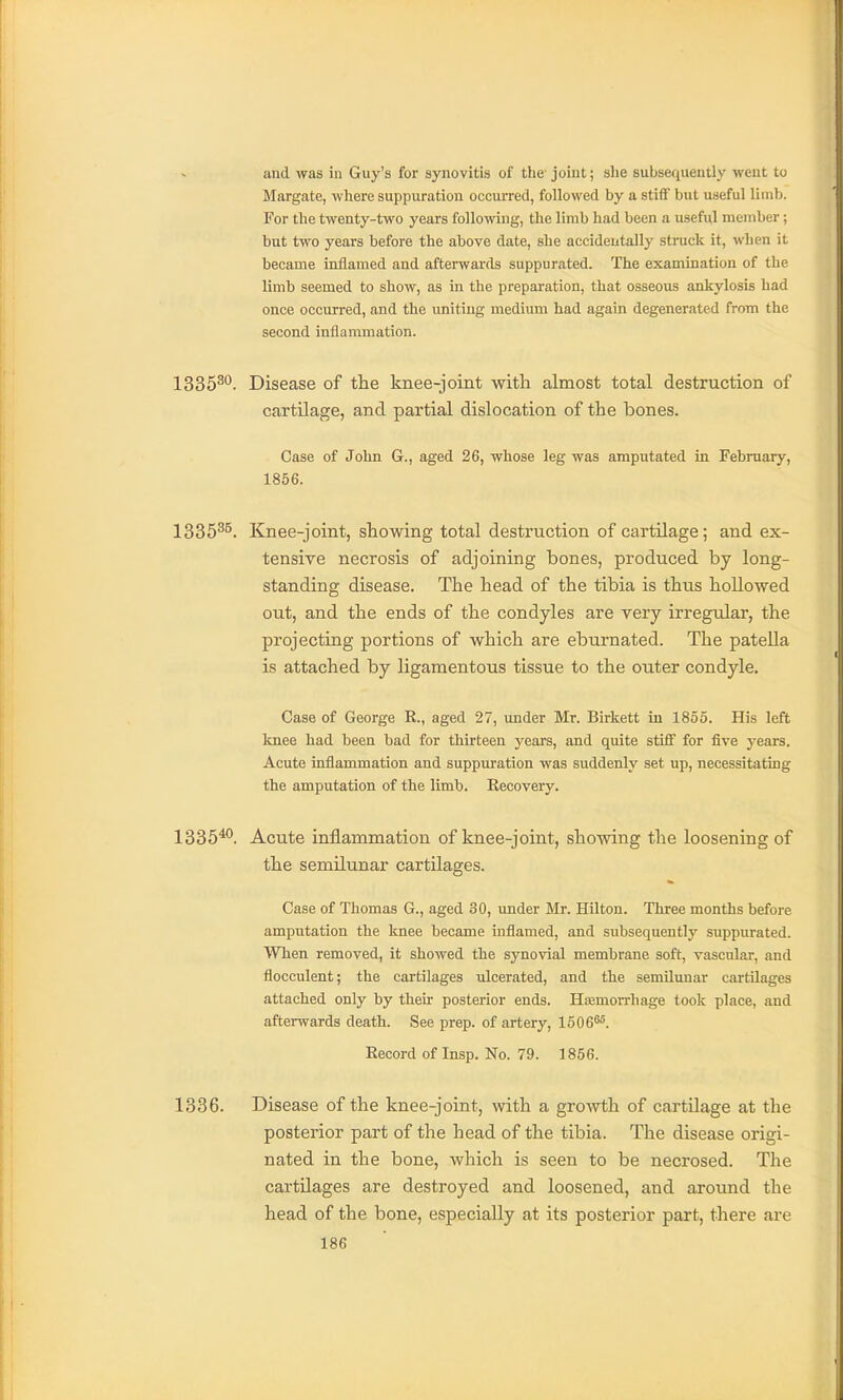 and was in Guy's for synovitis of the- joint; she subsequently went to Margate, where suppuration occurred, followed by a stiff but useful limb. For the twenty-two years following, the limb had been a useful member; but two years before the above date, she accidentally struck it, when it became inflamed and afterwards suppurated. The examination of the limb seemed to show, as in the preparation, that osseous ankylosis had once occurred, and the uniting medium had again degenerated from the second inflammation. ISSS^*^. Disease of the knee-joint with almost total destruction of cartUage, and partial dislocation of the bones. Case of John G., aged 26, whose leg was amputated in February, 1856. 1335^^. Knee-joint, showing total destruction of cartilage; and ex- tensive necrosis of adjoining bones, produced by long- standing disease. The head of the tibia is thus hollowed out, and the ends of the condyles are very irregular, the projecting portions of which are eburnated. The patella is attached by ligamentous tissue to the outer condyle. Case of George R., aged 27, under Mr. Birkett in 1855. His left knee had been bad for thirteen years, and quite stiflf for five years. Acute inflammation and suppuration was suddenly set up, necessitating the amputation of the limb. Recovery. 1335^. Acute inflammation of knee-joint, showing the loosening of the semilunar cartilages. Case of Thomas G., aged 30, under Mr. Hilton. Three months before amputation the knee became inflamed, and subsequently suppurated. When removed, it showed the synovial membrane soft, vascular, and flocculent; the cartilages ulcerated, and the semilunar cartilages attached only by their posterior ends. Hajmorrhage took place, and afterwards death. See prep, of artery, 1506^. Record of Insp. No. 79. 1856. 1336. Disease of the knee-joint, with a growth of cartilage at the posterior part of the head of the tibia. The disease origi- nated in the bone, which is seen to be necrosed. The cartilages are destroyed and loosened, and around the head of the bone, especially at its posterior part, there are