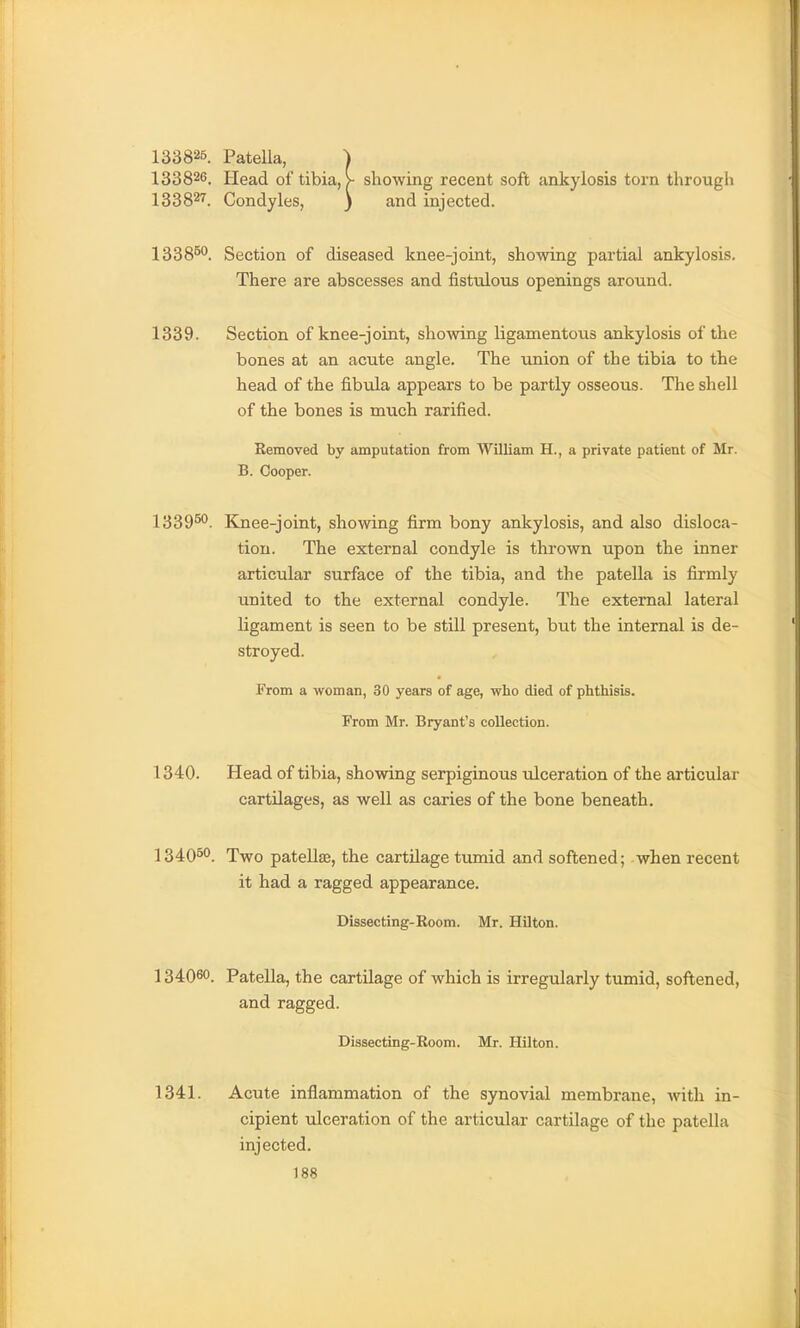 133826. PateUa, i 133826. Head of tibia, >• showing recent soft ankylosis torn through 133827. Condyles, ) and injected. 1338^^. Section of diseased knee-joint, showing partial ankylosis. There are abscesses and fistulous openings around. 1339. Section of knee-joint, showing ligamentous ankylosis of the bones at an acute angle. The union of the tibia to the head of the fibula appears to be partly osseous. The shell of the bones is much rarified. Removed by amputation from William H., a private patient of Mr. B. Cooper. 1339^. Knee-joint, showing firm bony ankylosis, and also disloca- tion. The external condyle is thrown upon the inner articular surface of the tibia, and the patella is firmly united to the external condyle. The external lateral ligament is seen to be still present, but the internal is de- stroyed. From a woman, 30 years of age, who died of phthisis. From Mr. Bryant's collection. 1340. Head of tibia, showing serpiginous ulceration of the articular cartilages, as well as caries of the bone beneath. 134050. Two pateUse, the cartilage tumid and softened; when recent it had a ragged appearance. Dissecting-Room. Mr. Hilton. 134060. Patella, the cartilage of which is irregularly tumid, softened, and ragged. Dissecting-Room. Mr. Hilton. 1341. Acute inflammation of the synovial membrane, Avith in- cipient ulceration of the articular cartilage of the patella injected.