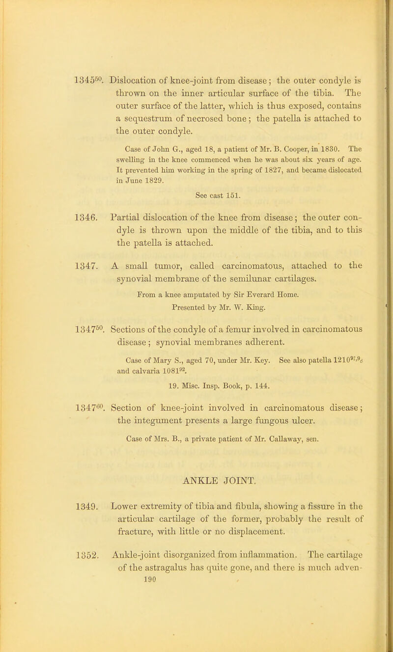 1345^*^. Dislocation of knee-joint from disease; the outer condyle is thrown on the inner articular surface of the tibia. The outer surface of the latter, which is thus exposed, contains a sequestrum of necrosed bone; the patella is attached to the outer condyle. Case of John G., aged 18, a patient of Mr. B. Cooper, in 1830. The sweUing in the knee commenced when he was about six years of age. It prevented him working in the spring of 1827, and became dislocated in June 1829. See cast 151. 1346. Partial dislocation of the knee from disease; the outer con- dyle is thrown upon the middle of the tibia, and to this the patella is attached. 1347. A small tumor, called carcinomatous, attached to the synovial membrane of the semilunar cartilages. From a knee amputated by Sir Everard Home. Presented by Mr. W. King. 1347^''. Sections of the condyle of a femur involved in carcinomatous disease; synovial membranes adherent. Case of Mary S., aged 70, under Mr. Key. See also patella 1210*'>9i) and calvaria 1081^^. 19. Misc. Insp. Book, p. 144. 1347*^^. Section of knee-joint involved in carcinomatous disease; the integument presents a large ftmgous ulcer. Case of Mrs. B., a private patient of Mr. Callaway, sen. ANKLE JOINT. 1349. Lower extremity of tibia and fibula, showing a fissure in the articular cartilage of the former, probably the result of fracture, with little or no displacement. 1352. Ankle-joint disorganized from iuflammation. The cartilage of the astragalus has quite gone, and there is much adven-