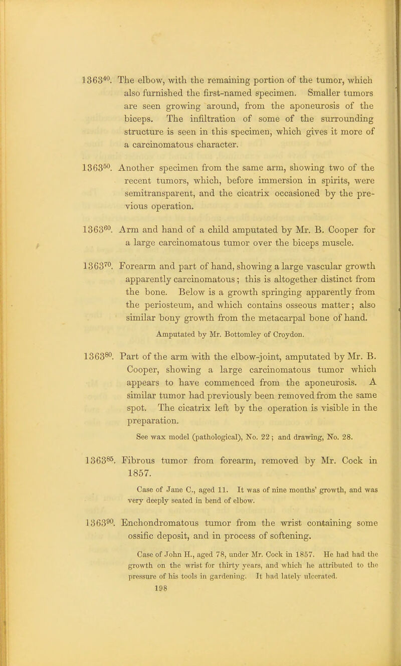 1363^^. The elbow, with the remaiuing portion of the tumor, which also furnished the first-named specimen. Smaller tumors are seen growing around, from the aponeurosis of the biceps. The infiltration of some of the surrounding structure is seen in this specimen, which gives it more of a carcinomatous character. 1363^*^. Another specimen from the same arm, showing two of the recent tumors, which, before immersion in spirits, were semitransparent, and the cicatrix occasioned by the pre- vious operation. 1363^^. Arm and hand of a child amputated by Mr. B. Cooper for a large carcinomatous tumor over the biceps muscle. 1363''^°. Forearm and part of hand, showing a large vascular growth apparently carcinomatous ; this is altogether distinct from the bone. Below is a growth springing apparently from the periosteum, and which contains osseous matter; also similar bony growth from the metacarpal bone of hand. Amputated by Mr. Bottomley of Croydon. 1363^°. Part of the arm with the elbow-joint, amputated by ]\Ir. B. Cooper, showing a large carcinomatous tumor which appears to have commenced from the aponeurosis. A similar tumor had previously been removed from the same spot. The cicatrix left by the operation is visible in the preparation. See wax model (pathological), No. 22 ; and drawing, No. 28. 1363^^. Fibrous tumor from forearm, removed by Mr. Cock in 1857. Case of Jane C, aged 11. It was of nine months' growth, and was very deeply seated in bend of elbow. 1363^. Enchondromatous tumor from the wrist containing some ossific deposit, and in process of softening. Case of John II., aged 78, under Mr. Cock in 1857. He had had the growth on the wrist for thirty years, and which he attributed to tlie pressure of his tools in gardening. It had lately ulcerated.