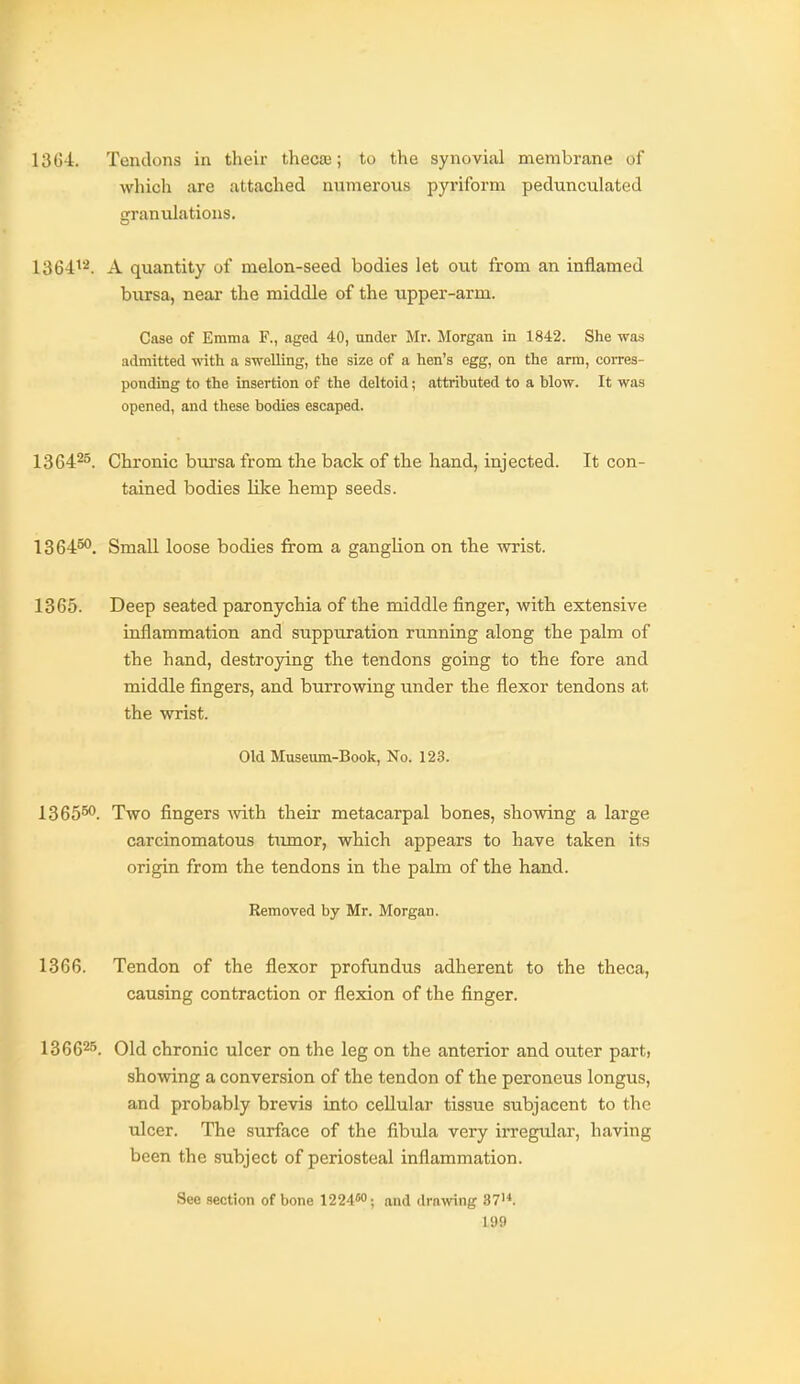 13(54. Tendons in their thec£E; to the synovial membrane of which are attached numerous pyriform pedunculated granulations. 1364^'^. A quantity of melon-seed bodies let out from an inflamed biirsa, near the middle of the upper-arm. Case of Emma F., aged 40, under Mr. Morgan in 1842. She was admitted with a swelling, the size of a hen's egg, on the arm, corres- ponding to the Insertion of the deltoid; attributed to a blow. It was opened, and these bodies escaped. 136425. Chronic bursa from the back of the hand, injected. It con- tained bodies like hemp seeds. 1364^. Small loose bodies from a ganglion on the wrist. 1365. Deep seated paronychia of the middle finger, with extensive inflammation and suppuration rimning along the palm of the hand, destroying the tendons going to the fore and middle fingers, and burrowing under the flexor tendons at the wrist. Old Museum-Book, No. 123. 1365^. Two fingers with their metacarpal bones, showing a large carcinomatous tiunor, which appears to have taken its origin from the tendons in the palm of the hand. Removed by Mr. Morgan. 1366. Tendon of the flexor profundus adherent to the theca, causing contraction or flexion of the finger. 1366^5. Old chronic ulcer on the leg on the anterior and outer part, showing a conversion of the tendon of the peroneus longus, and probably brevis into cellular tissue subjacent to the ulcer. The surface of the fibula very ii-regular, having been the subject of periosteal inflammation. See section of bone 1224''; and drawing 37'*.