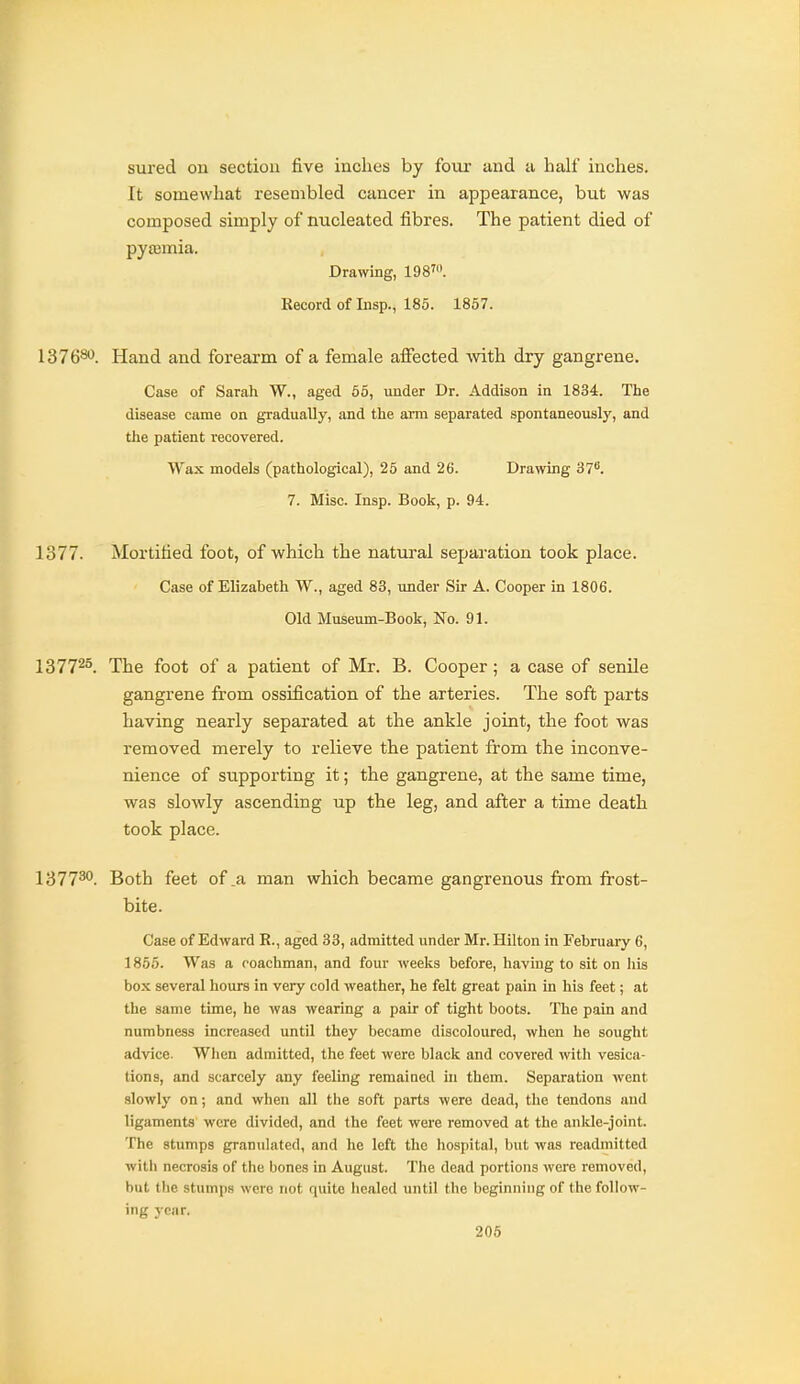 sured on section five inches by foiar and u half inches. It somewhat resembled cancer in appearance, but was composed simply of nucleated fibres. The patient died of pyemia. Drawing, 198'. Kecord of Insp., 185. 1867. 1376*^. Hand and forearm of a female affected -with dry gangrene. Case of Sarah W., aged 65, under Dr. Addison in 1834. The disease came on gradually, and the arm separated spontaneously, and the patient recovered. Wax models (pathological), 25 and 26. Drawing 37^. 7. Misc. Insp. Book, p. 94. 1377. Mortified foot, of which the natural separation took place. Case of Elizabeth W., aged 83, under Sir A. Cooper in 1806. Old Museum-Book, No. 91. 13772°. The foot of a patient of Mr. B. Cooper; a case of senile gangrene from ossification of the arteries. The soft parts having nearly separated at the ankle joint, the foot was removed merely to relieve the patient from the inconve- nience of supporting it; the gangrene, at the same time, was slowly ascending up the leg, and after a time death took place. 137730. Both feet of .a man which became gangrenous from frost- bite. Case of Edward R., aged 33, admitted under Mr. Hilton in February 6, 1865. Was a coachman, and four weeks before, having to sit on his box several hours in very cold weather, he felt great pain in his feet; at the same time, he was wearing a pair of tight boots. The pain and numbness increased until they became discoloured, when he sought advice. When admitted, the feet were black and covered with vesica- tions, and scarcely any feeling remained in them. Separation went slowly on; and when all the soft parts were dead, the tendons and ligaments were divided, and the feet were removed at the ankle-joint. The stumps granulated, and he left the hospital, but was readmitted witli necrosis of the bones in August. The dead portions were removed, but the stumps were not quite healed until the beginning of the follow- ing year. 206